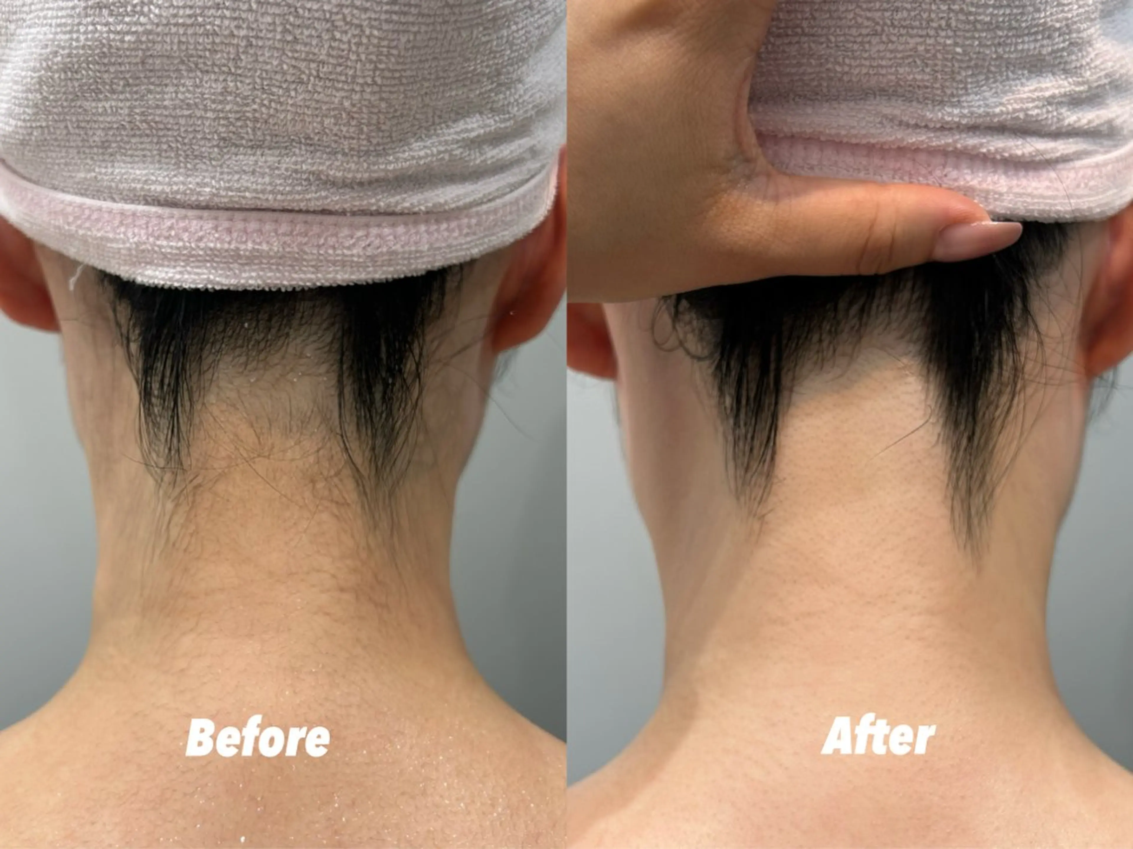 エステ リラク 🫧美しい素肌へ🫧 今成柚乃のその他イメージ