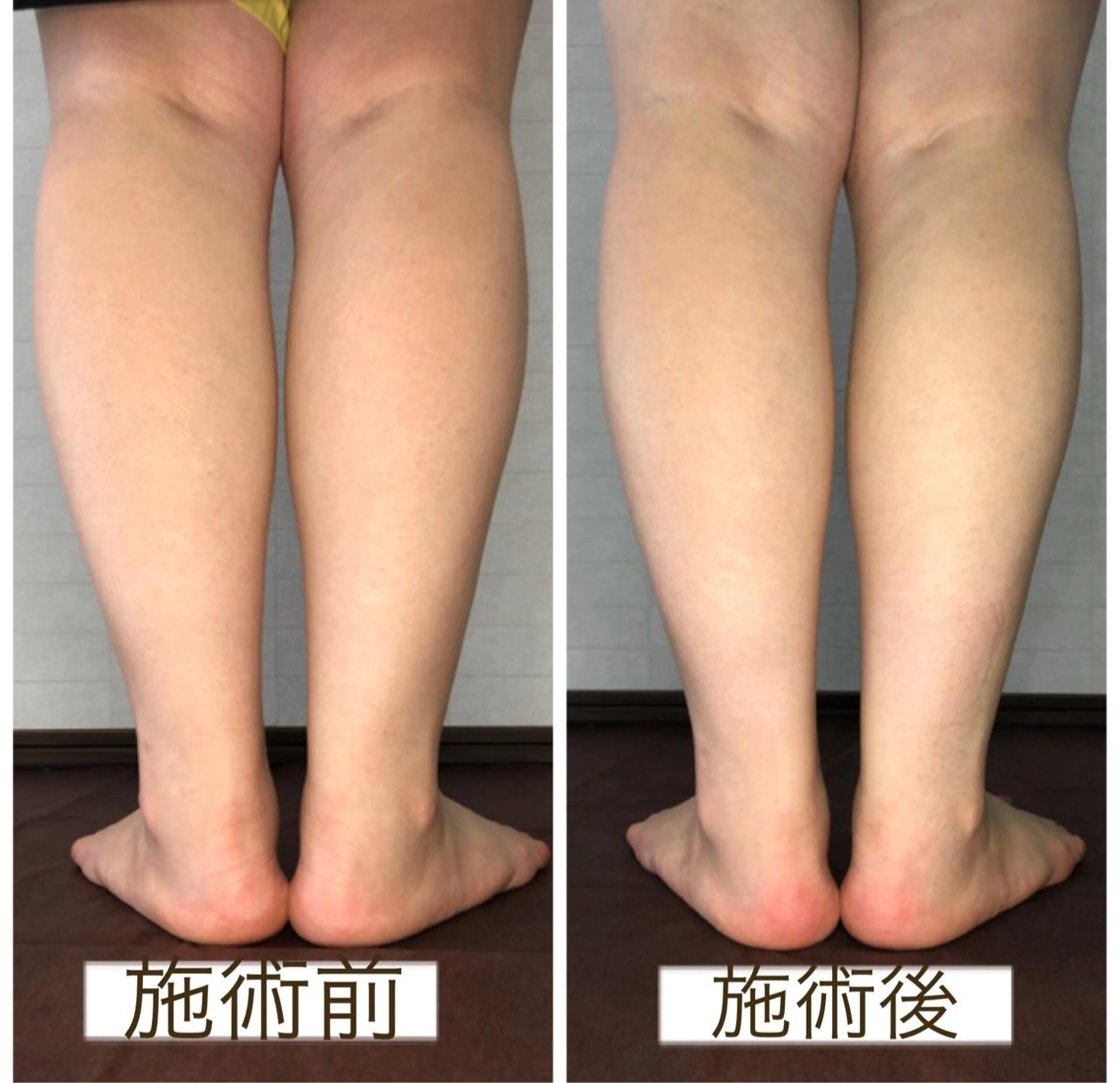 小顔・毛穴・たるみ ネイル　似内真樹のエステ・リラクイメージ