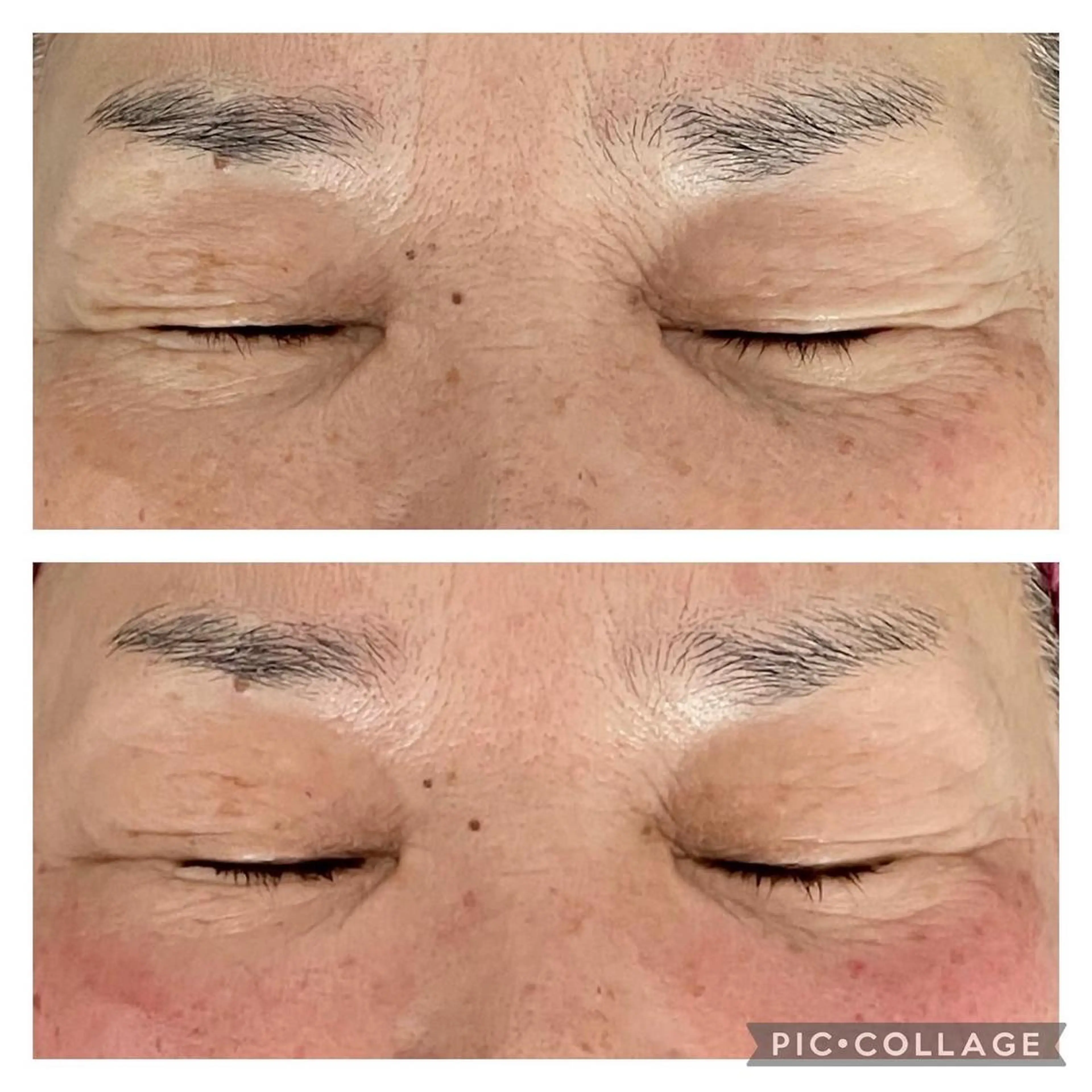 35歳からの エイジングケアサロンのエステ・リラクイメージ