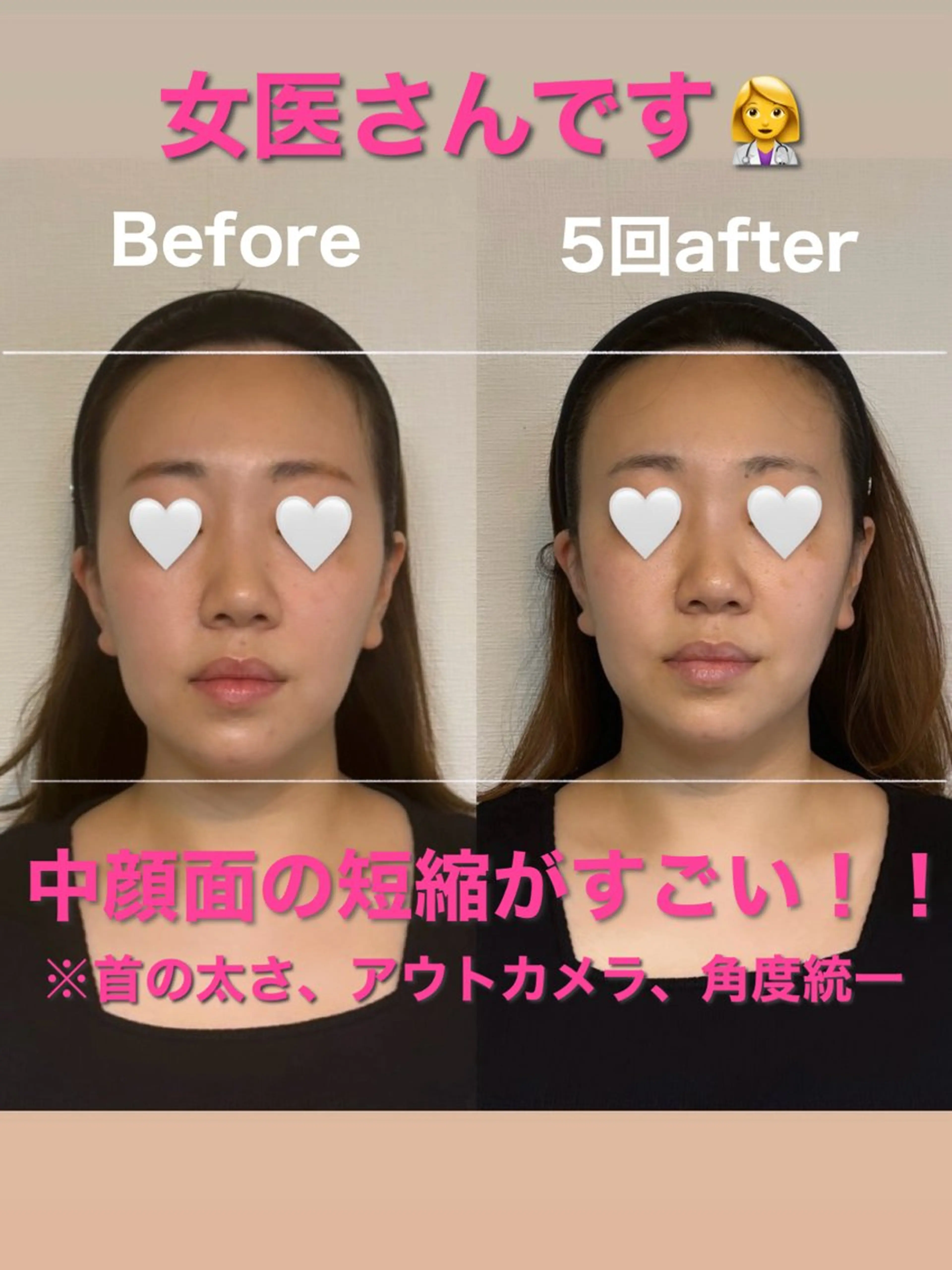 小顔矯正専門店Gémiey所属・越谷駅徒歩３分 小顔専門Gemieyのエステ・リラクイメージ