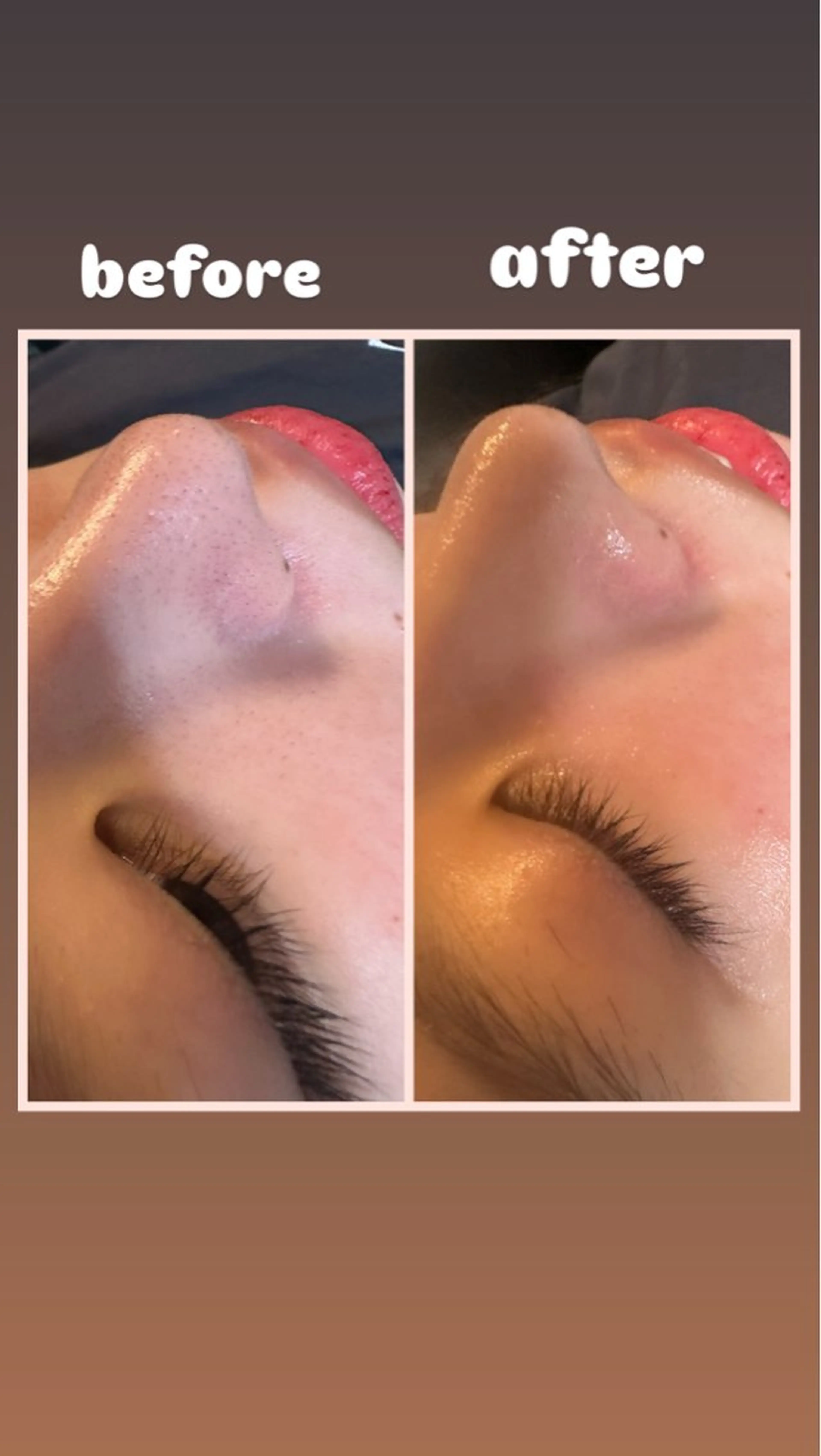 【人気✨】毛穴洗浄フェイシャルスペシャルの写真