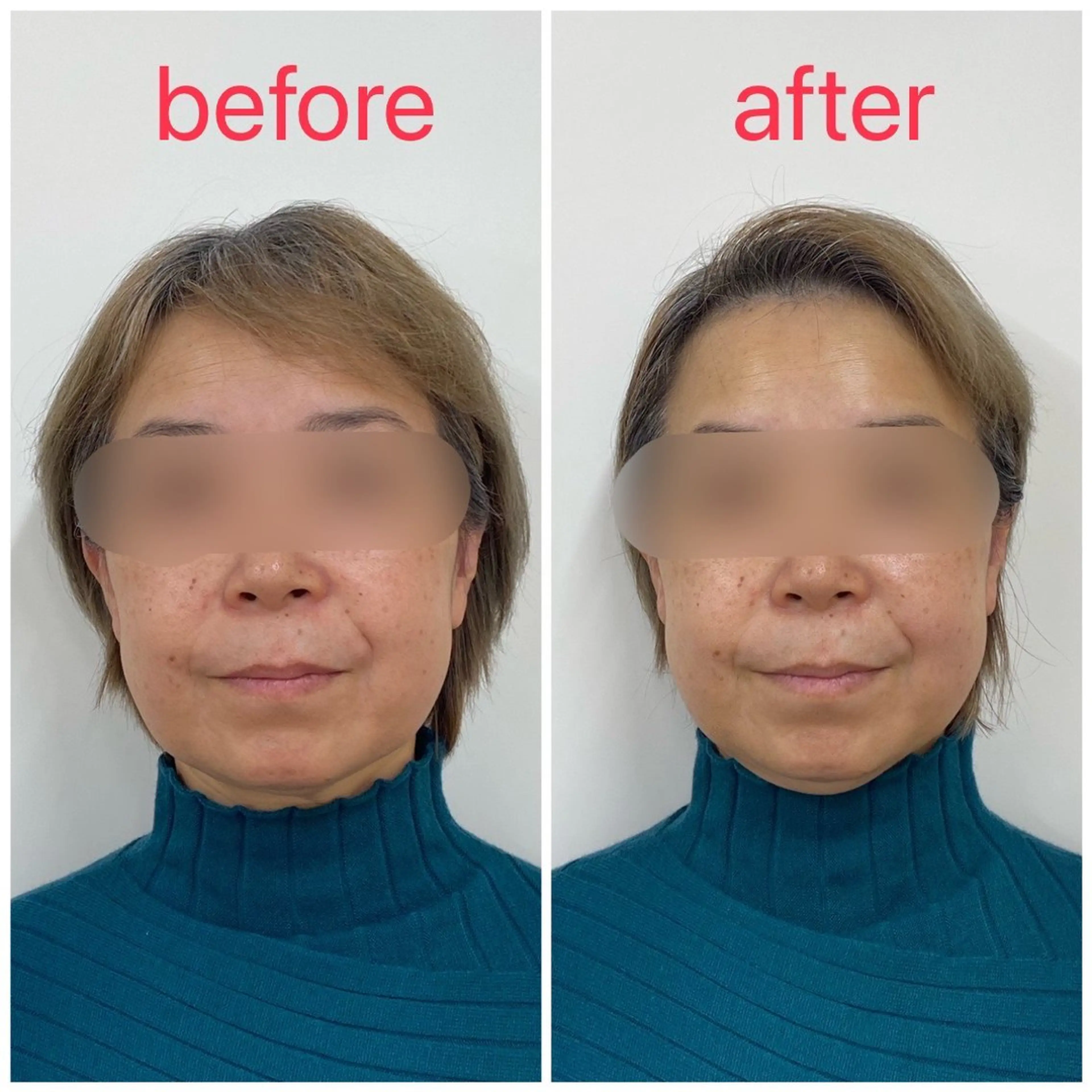 小顔矯正サロン Lilyのエステ・リラクイメージ