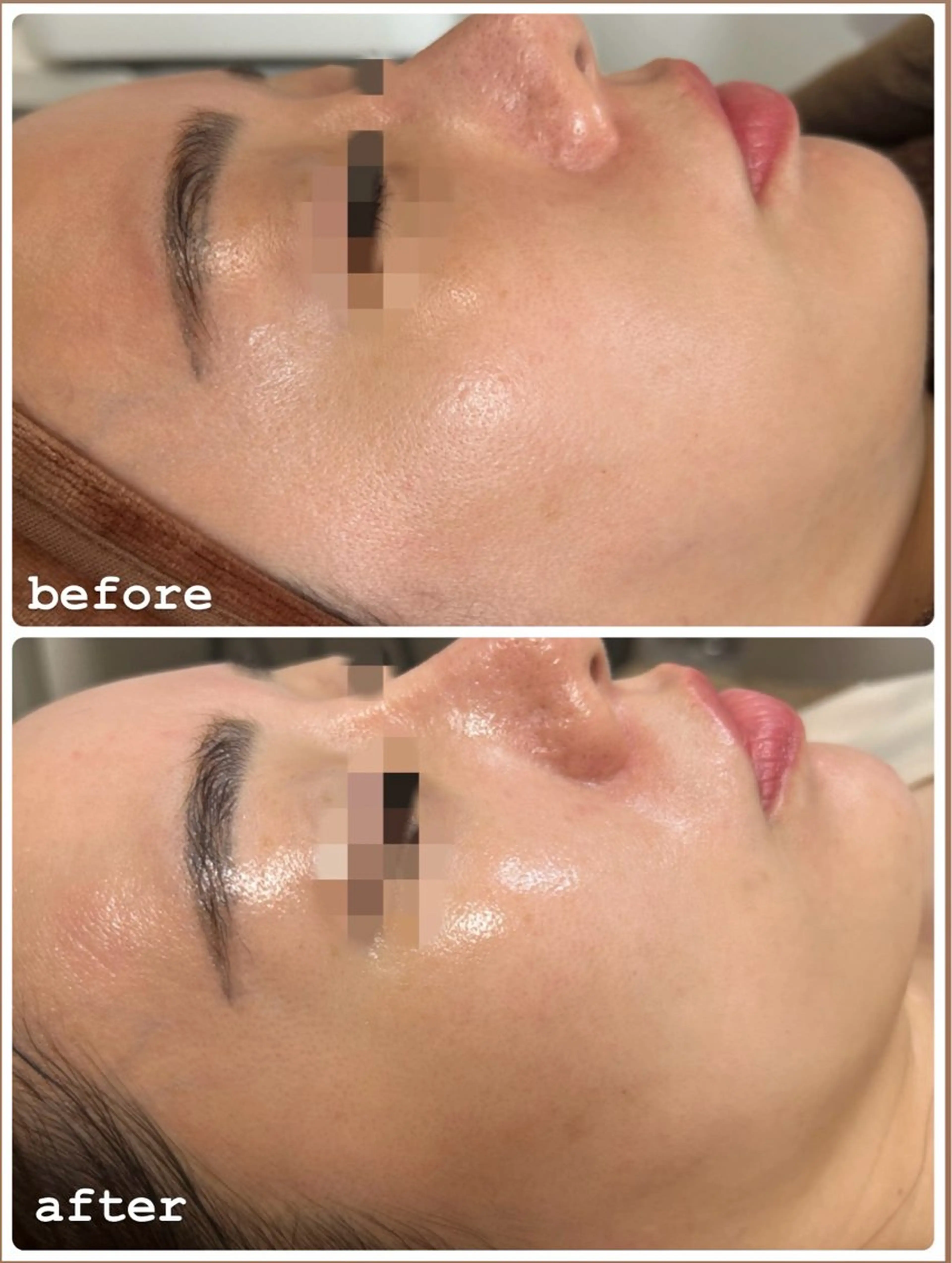 エステ beauty  salon sorelle所属・産毛角質ケア/艶肌 フェイシャルワックスのエステ・リラクイメージ