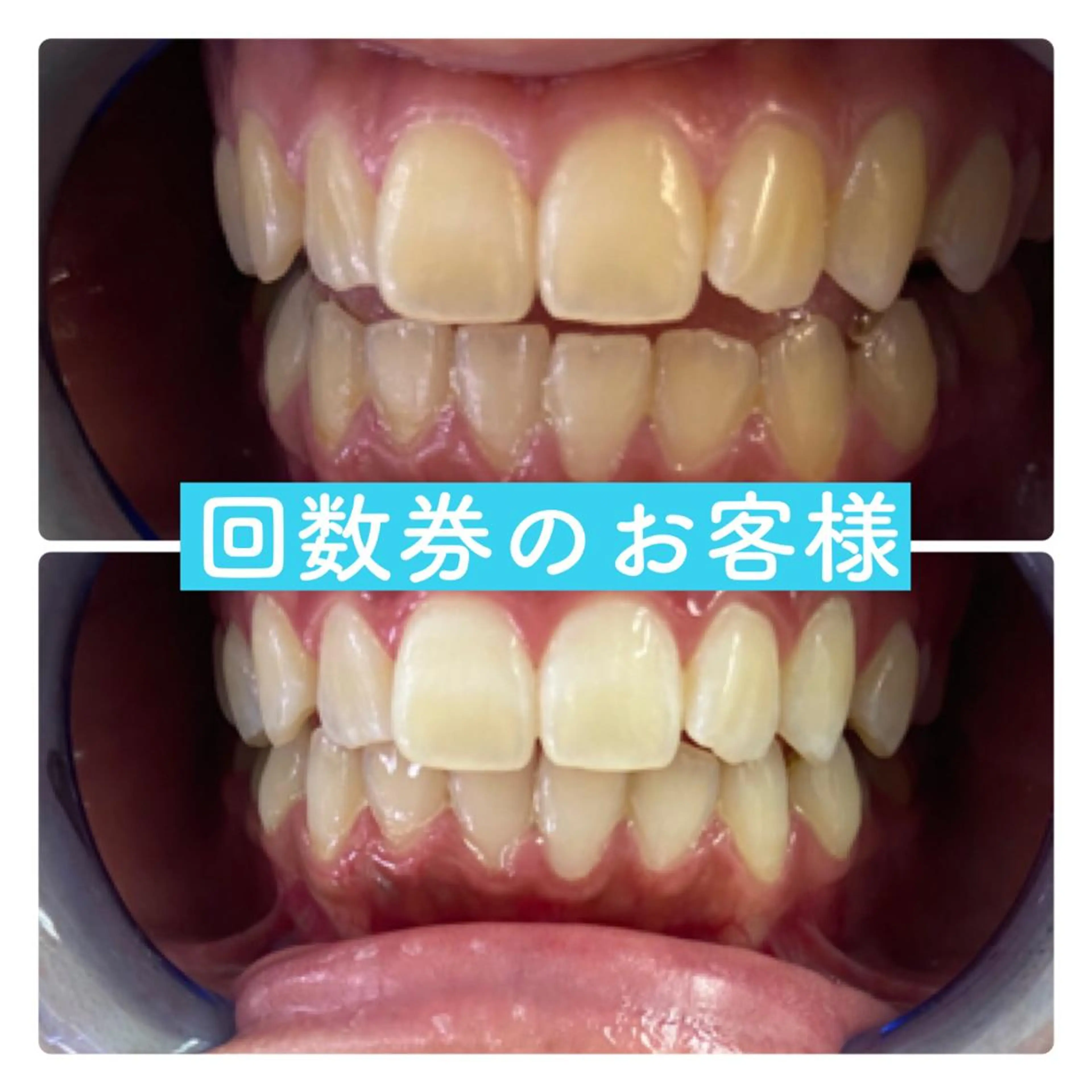 ホワイトニングルーム 横浜店のその他イメージ