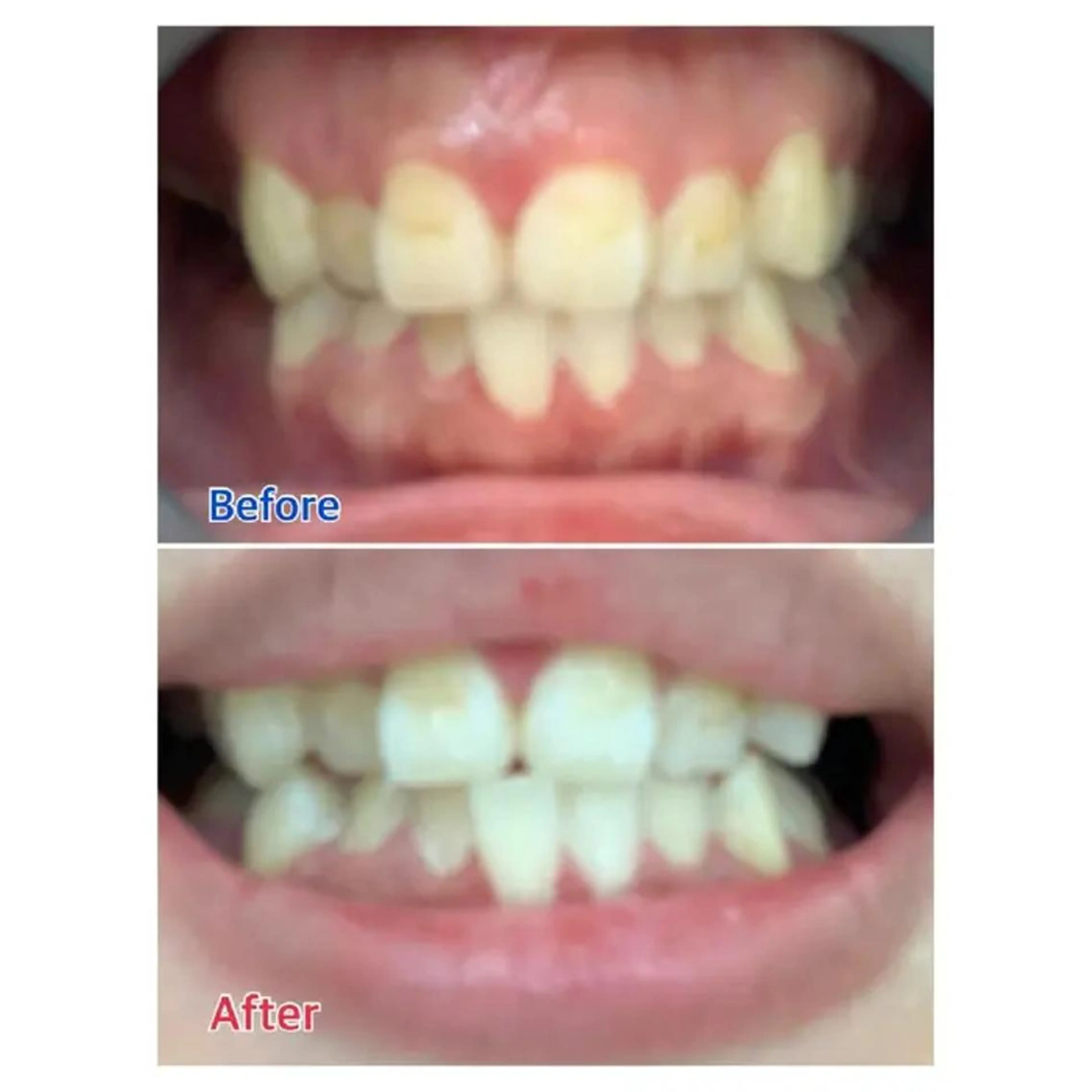 M渋谷 ホワイトニングのその他イメージ