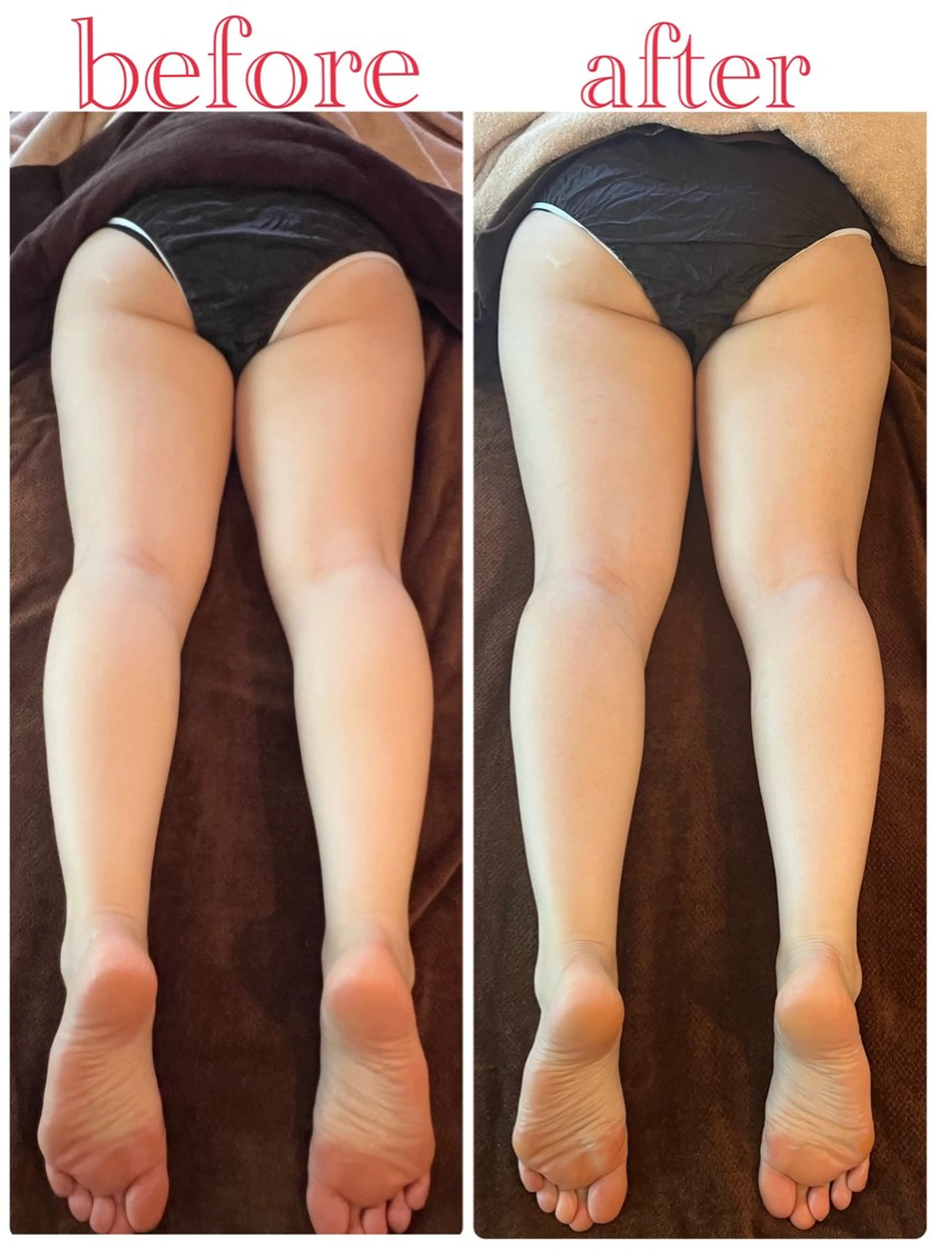 ハーブピーリング 痩身 漢方よもぎ蒸しのエステ・リラクイメージ