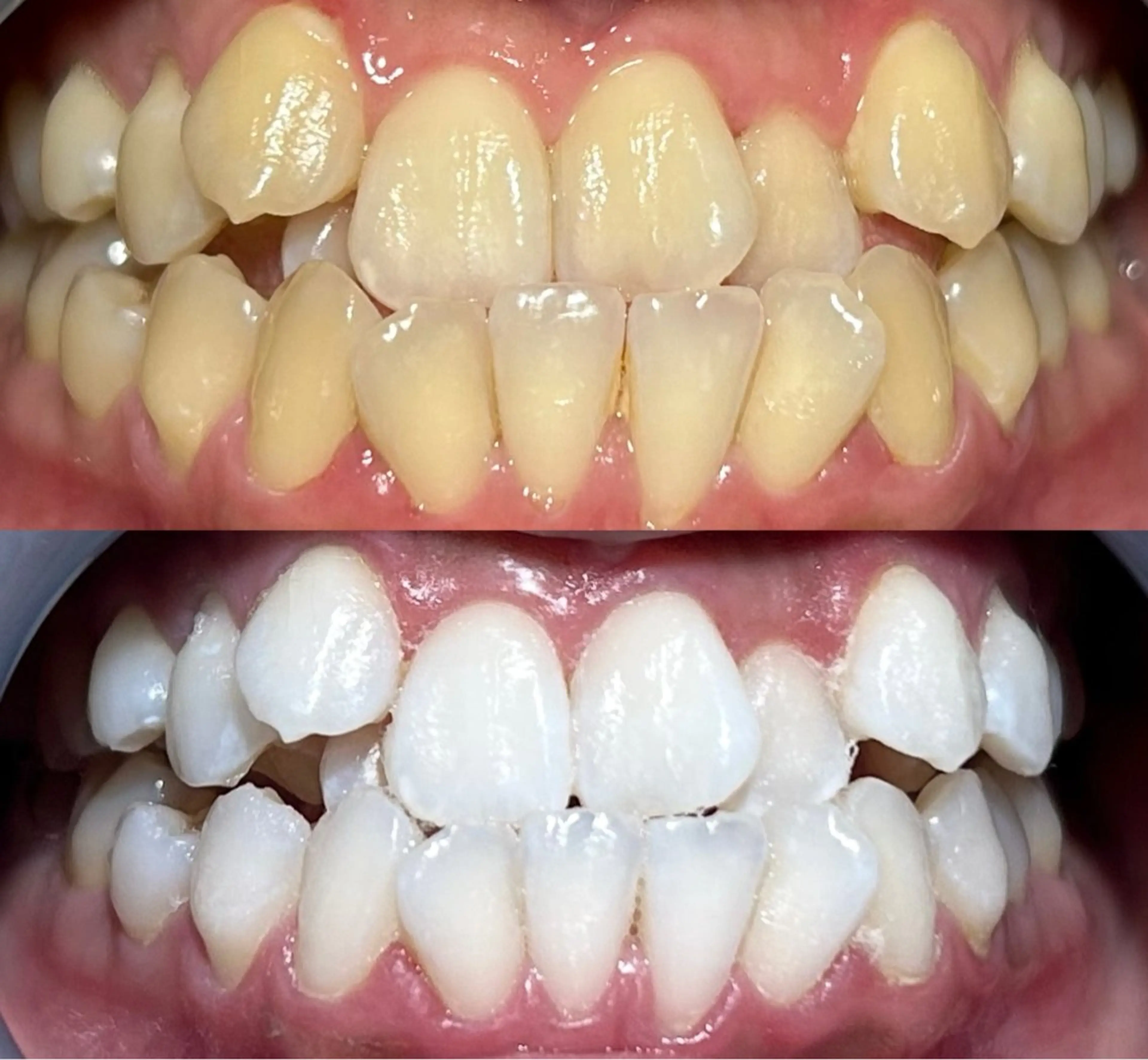 io teeth careのその他イメージ