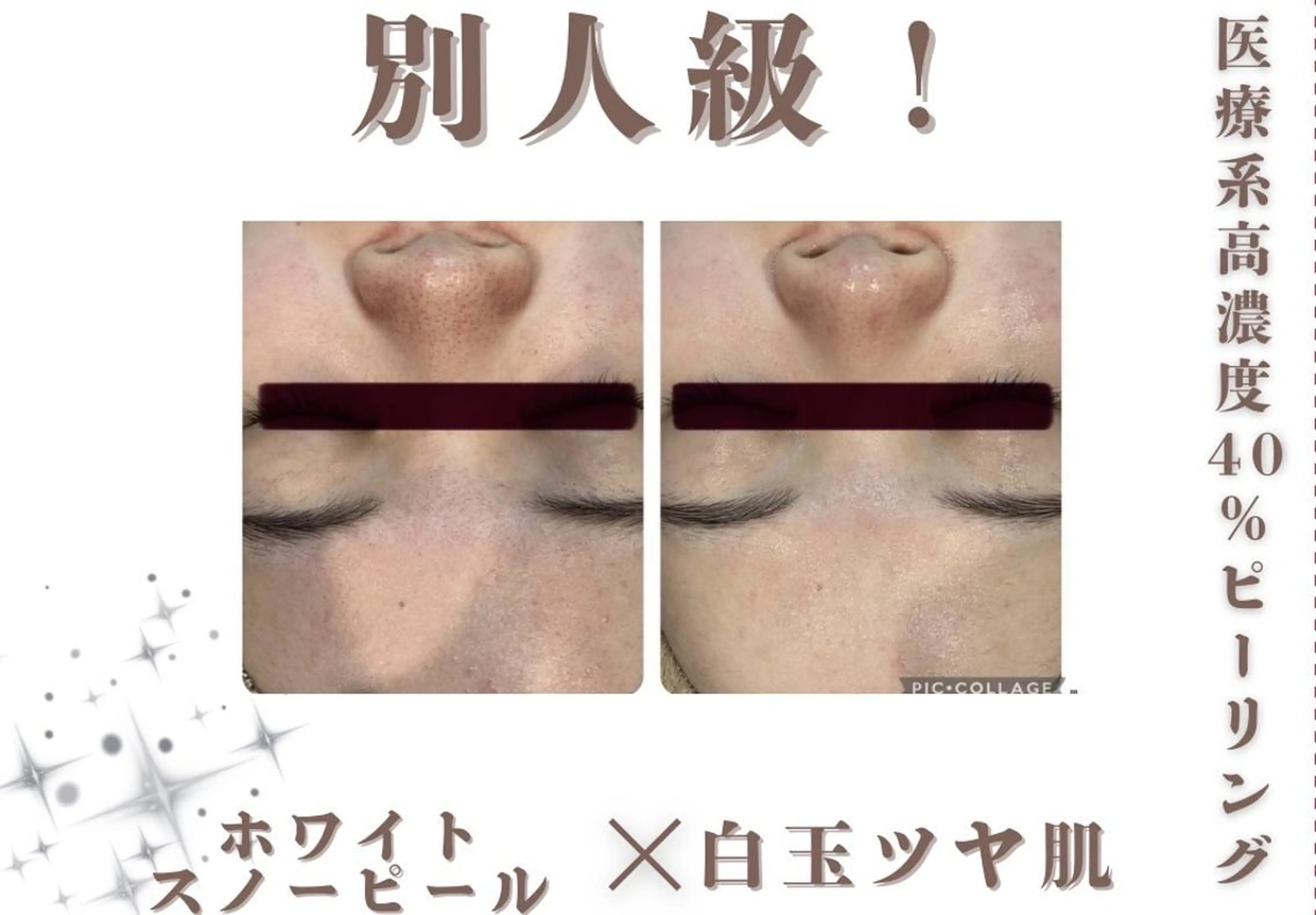 エステ 創業40周年✨美肌サ ロンRAYVIS銀座のエステ・リラクイメージ