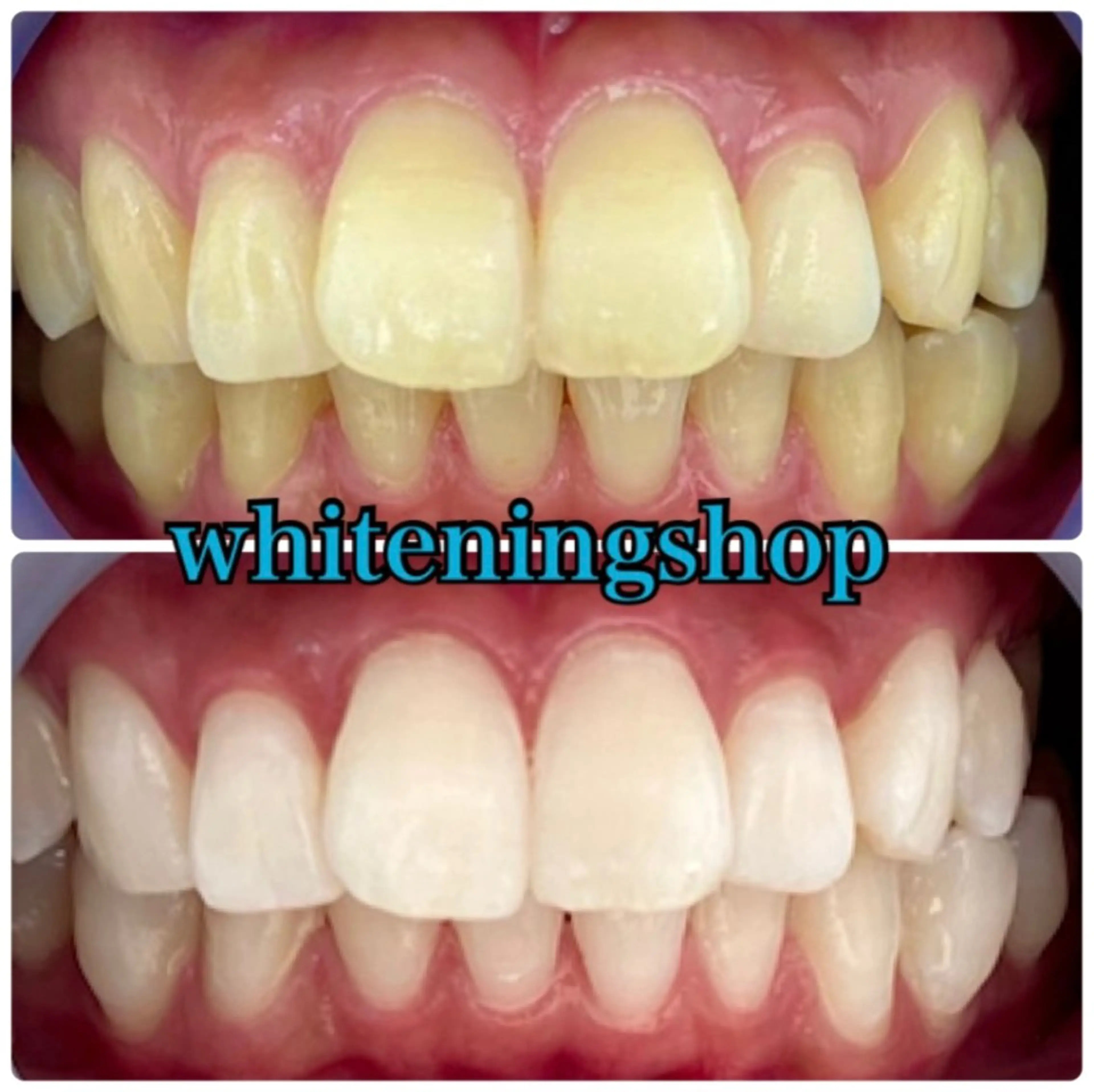 エステ リラク ホワイトニング ショップ吉祥寺店のエステ・リラクイメージ