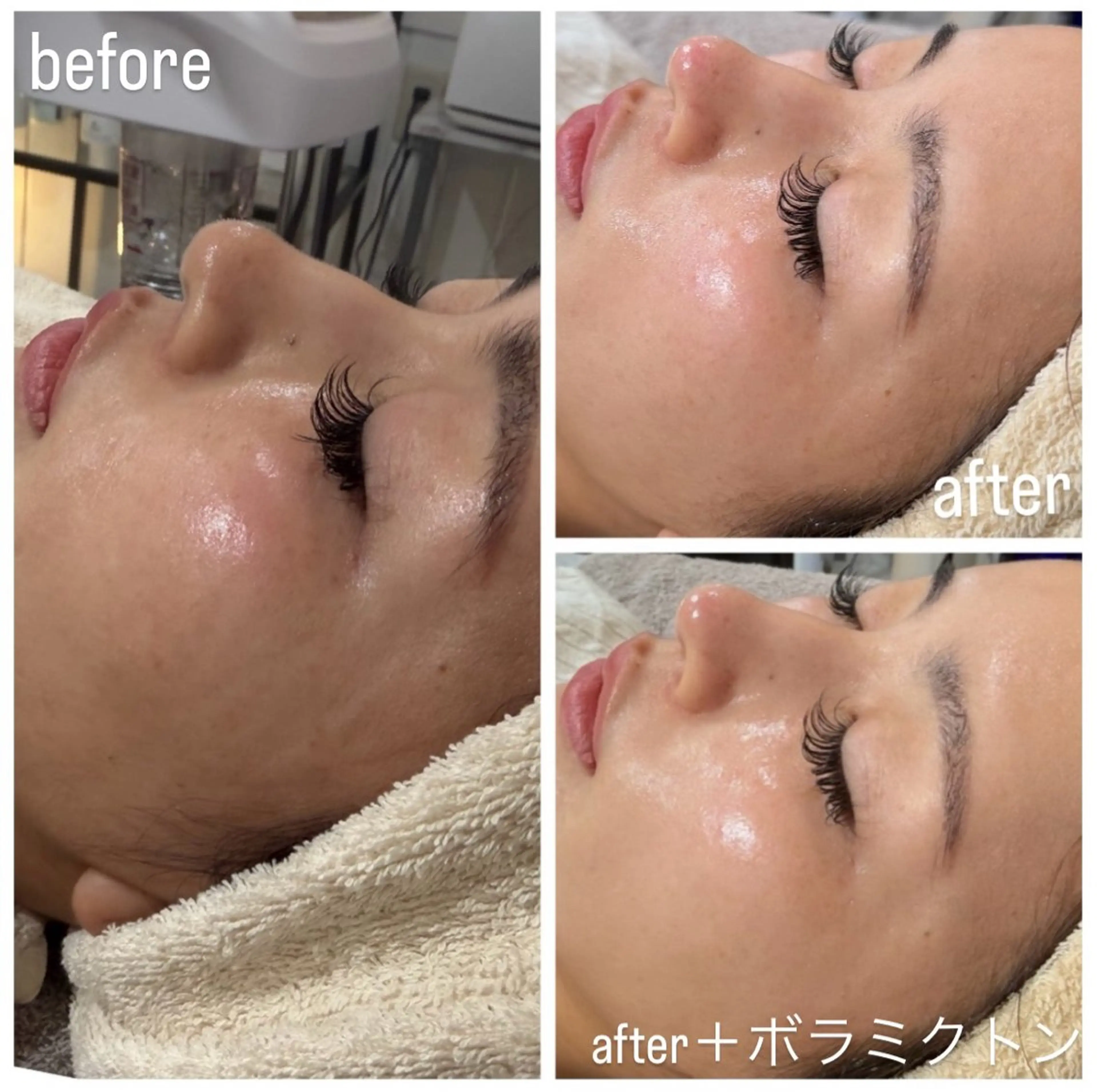 エステ Raviy 【痩身・韓国肌管理】のエステ・リラクイメージ