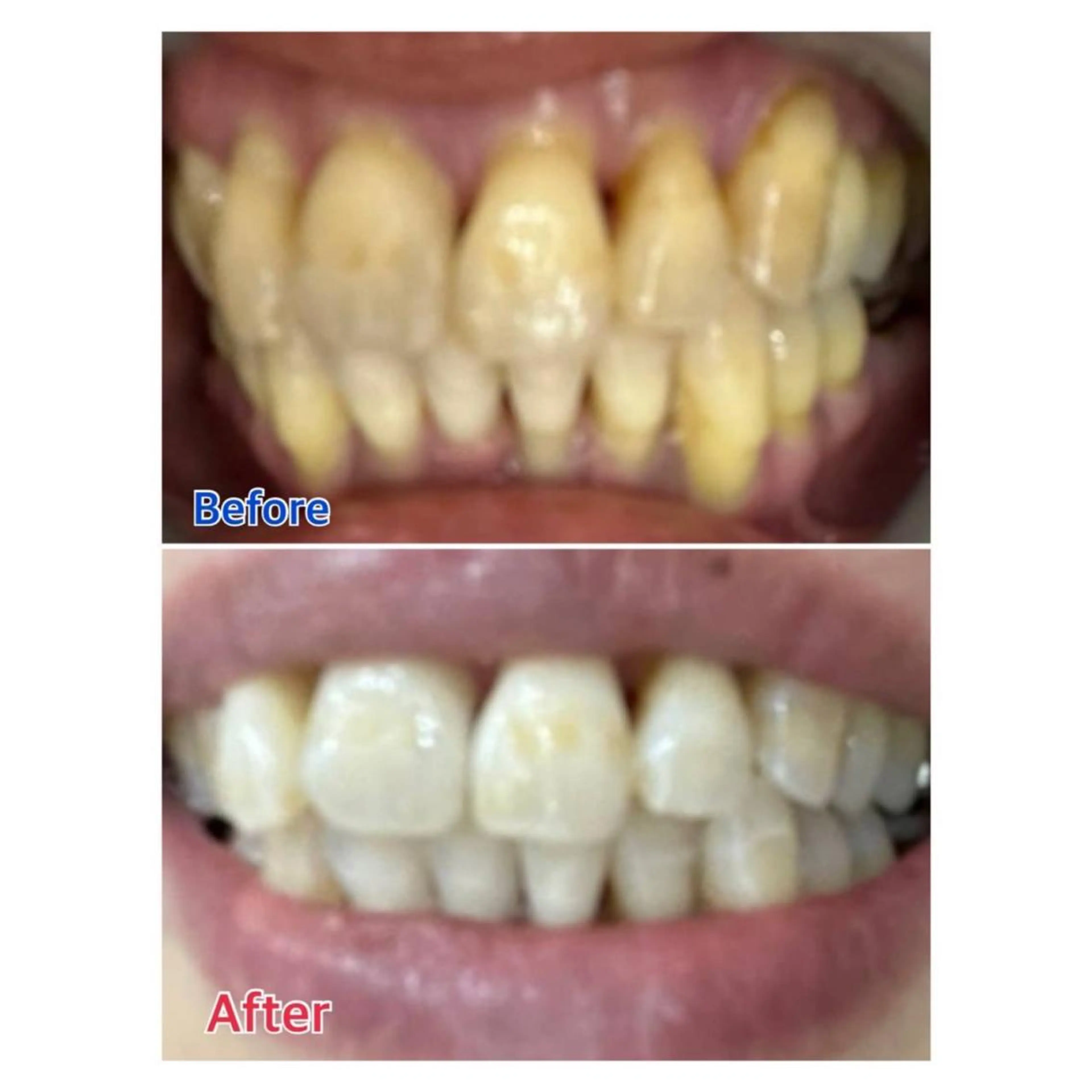 Melty 輝のその他イメージ