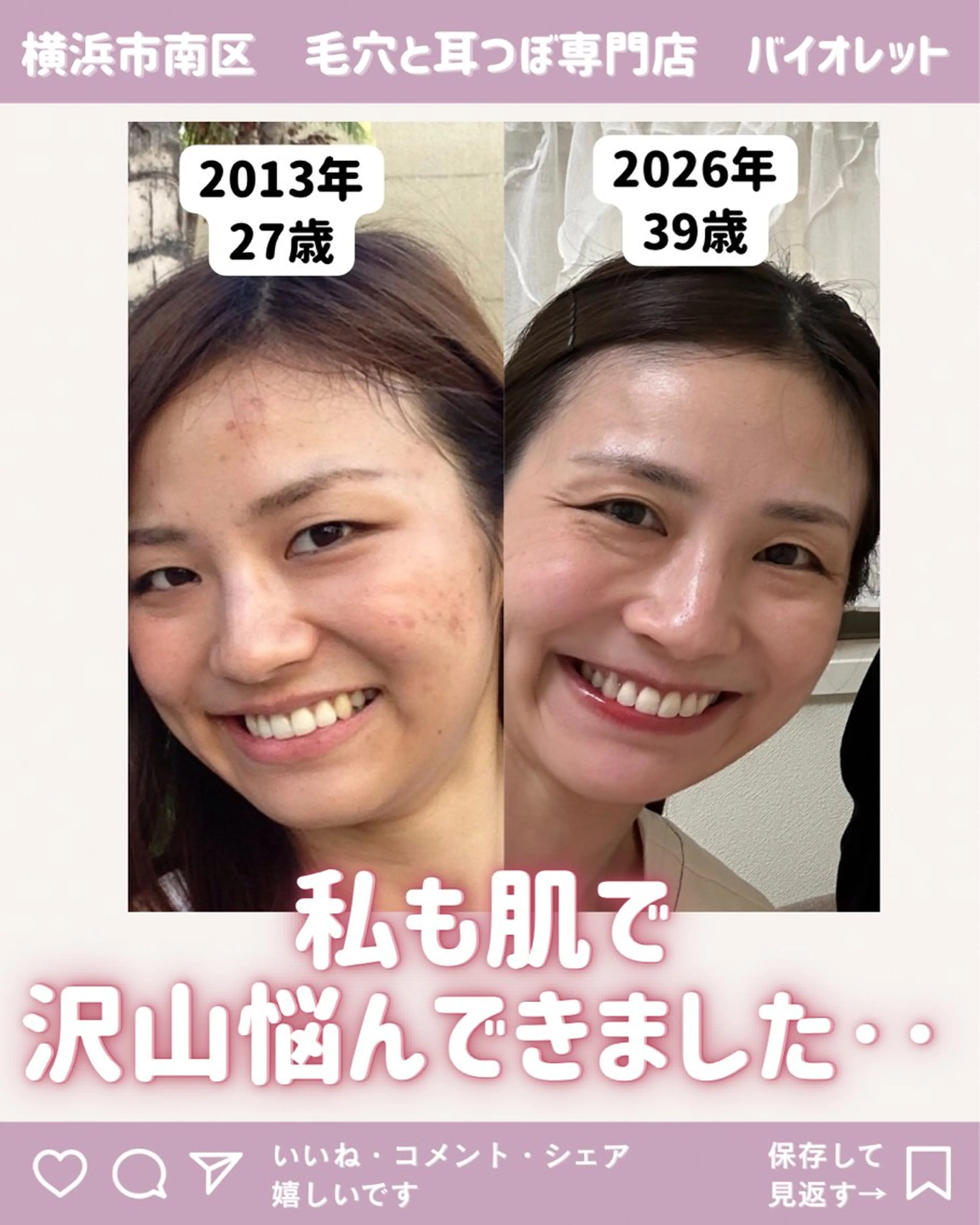 その他 毛穴と耳つぼ専門店 バイオレット　りののその他イメージ