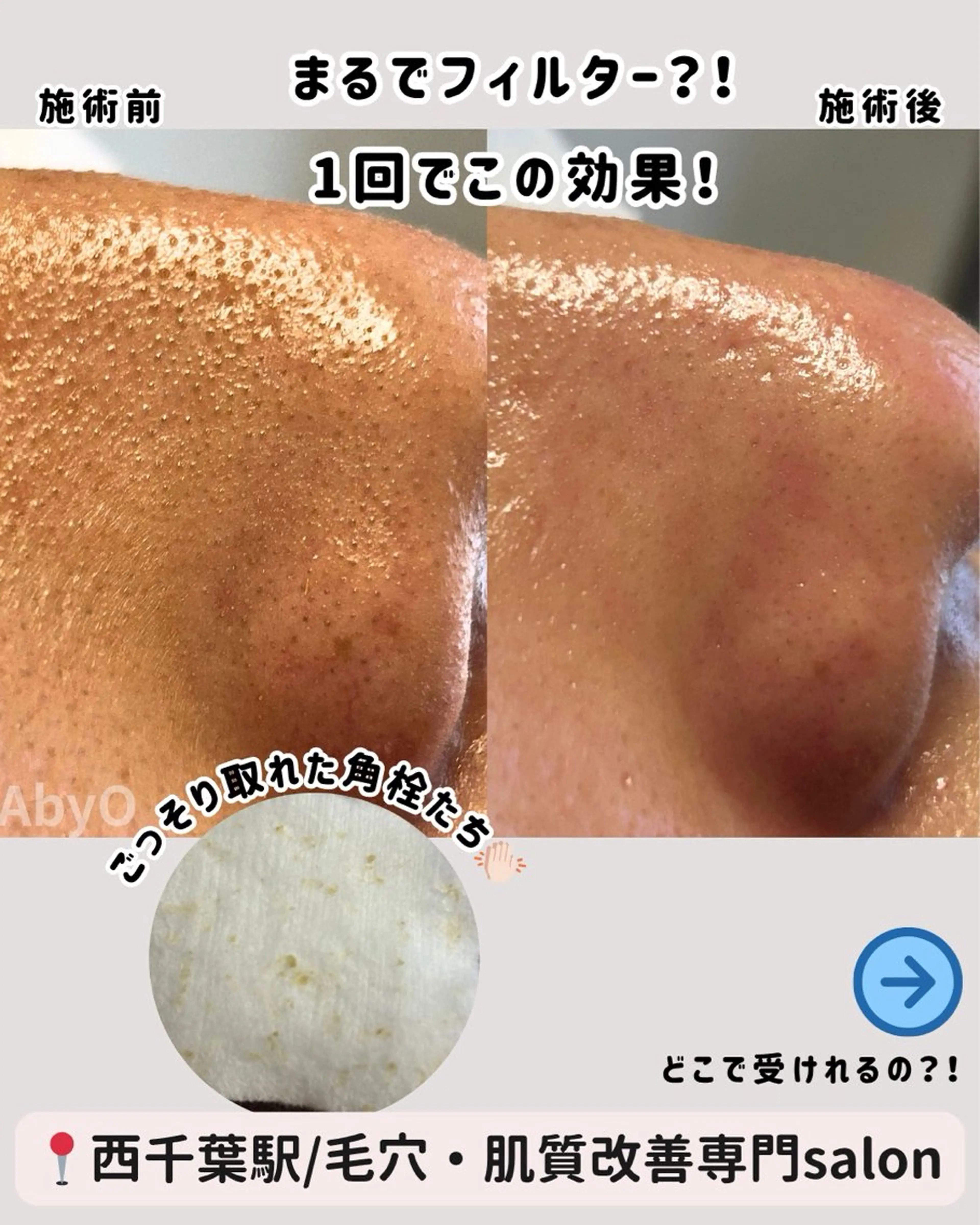 エステ AxO Aestheticのマツエク・マツパデザイン