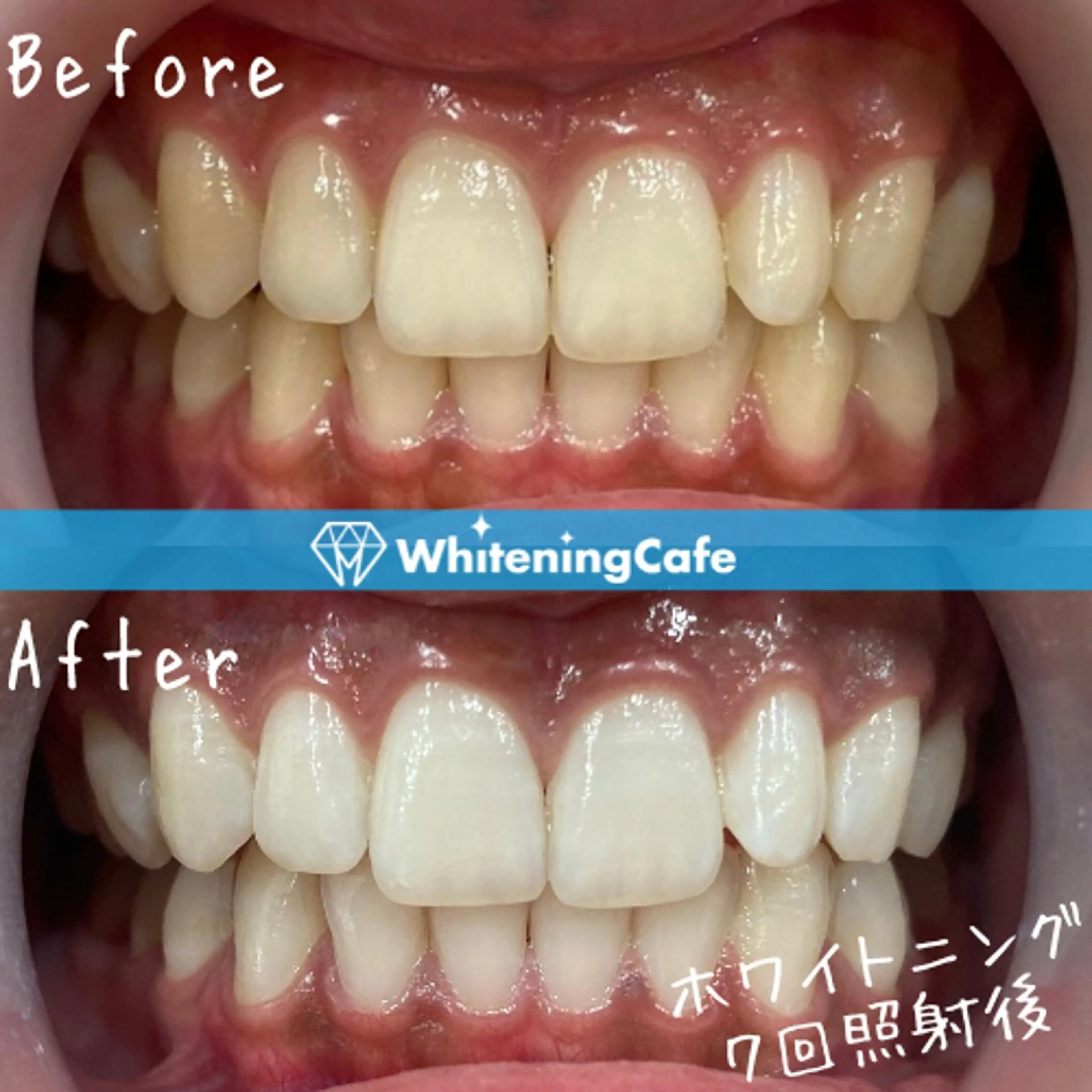 ホワイトニングカフェ 神戸元町店のエステ・リラクイメージ