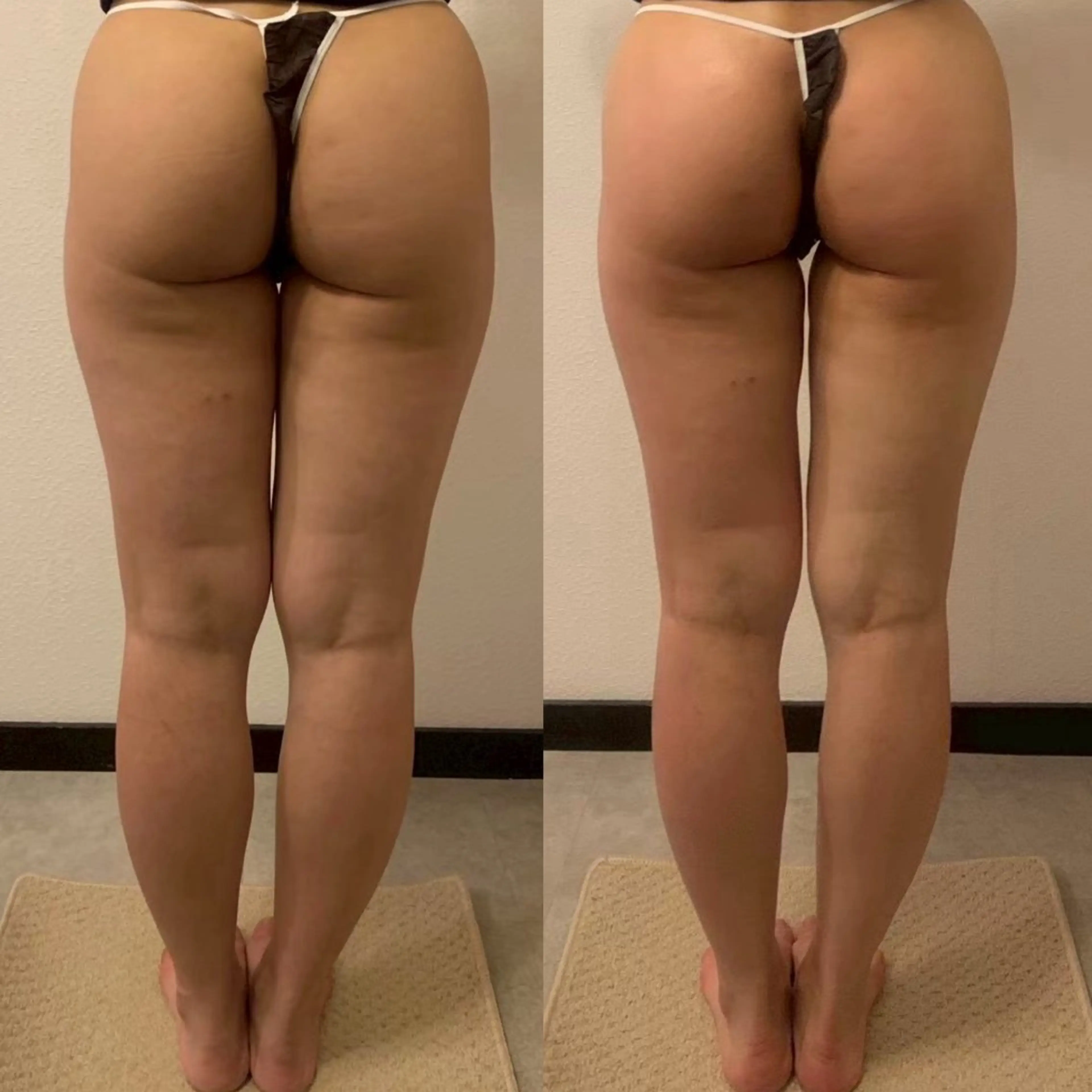 エステ 体重よりも見た目を 変える脚痩せサロンのエステ・リラクイメージ