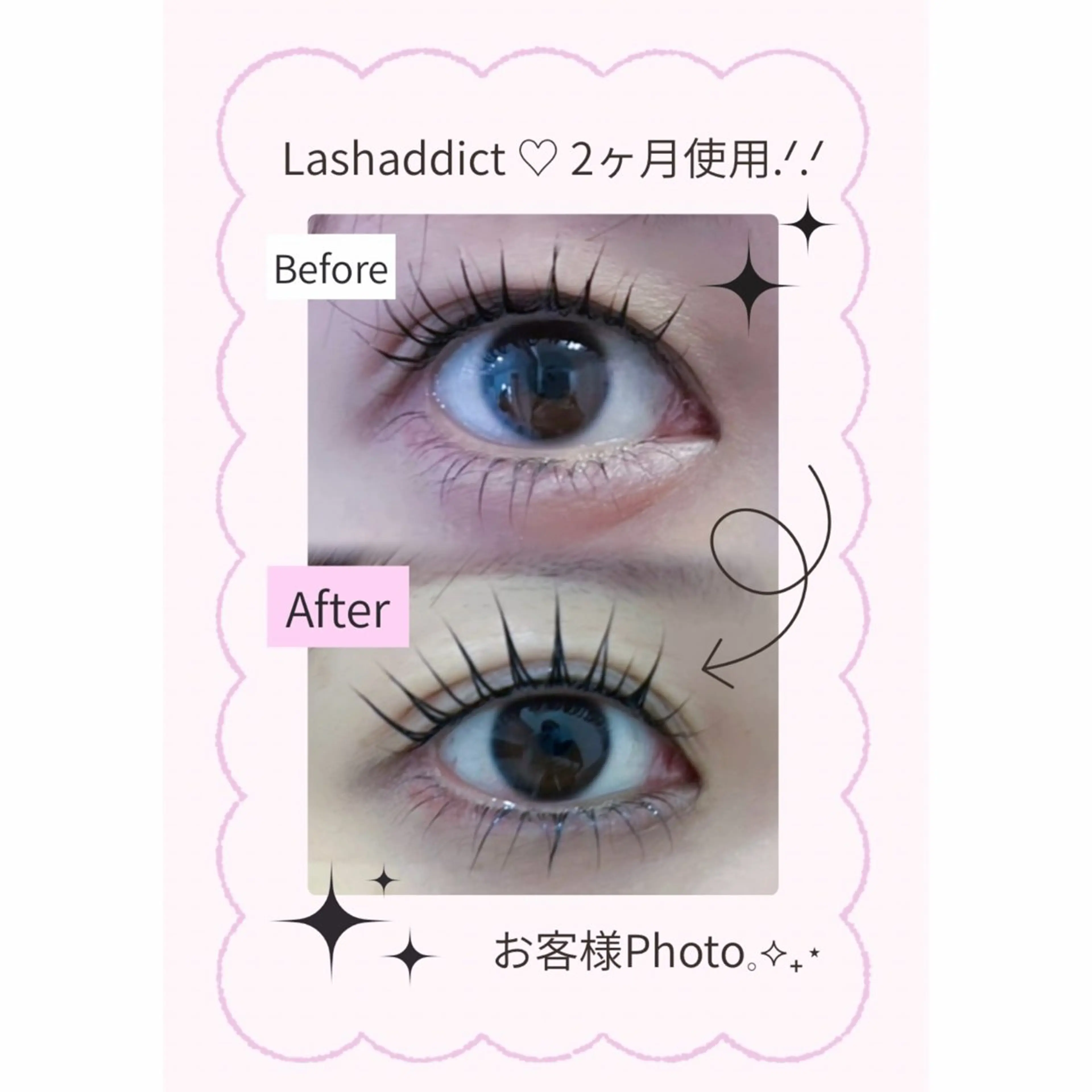 マツエク・マツパ マツパ 🍒🩵memelu 江坂駅前店🌟のマツエク・マツパデザイン