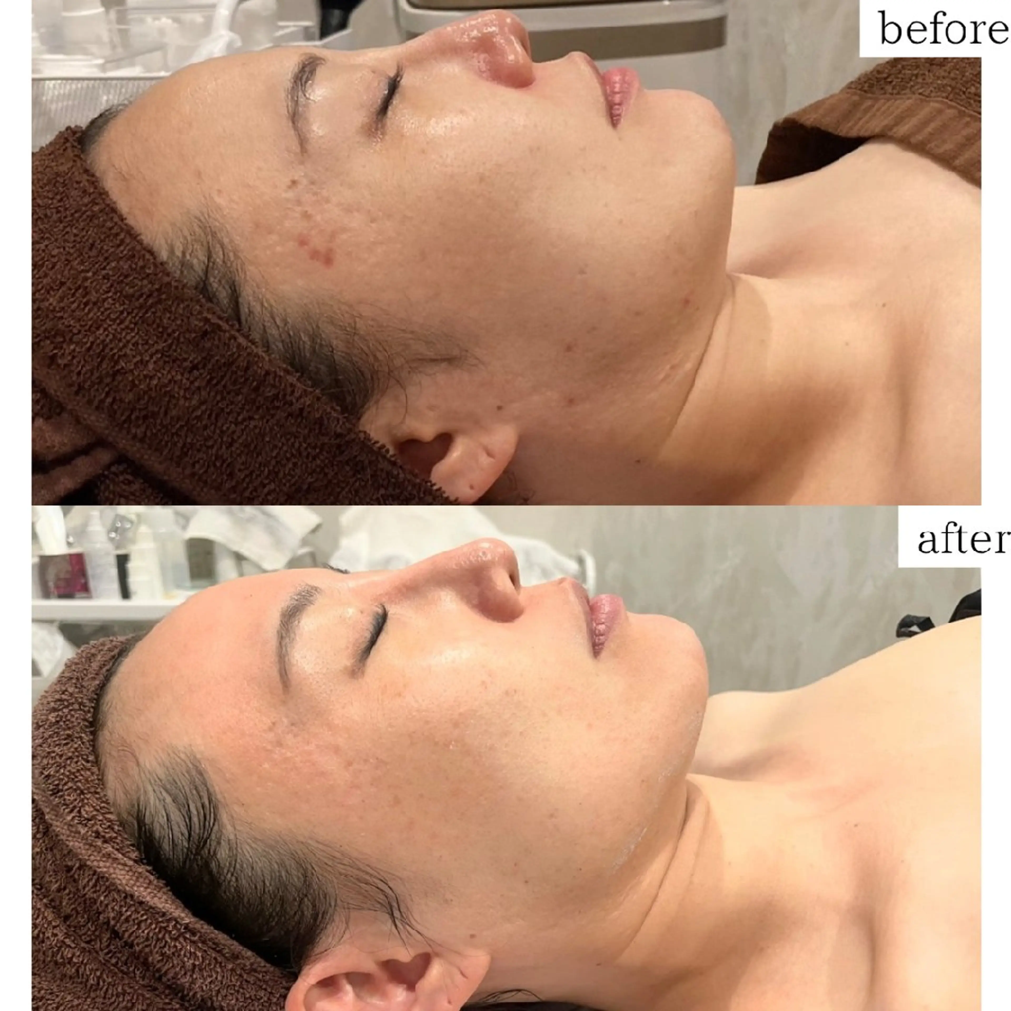 Dahlia痩身脱毛 フェイシャル 中村のエステ・リラクイメージ