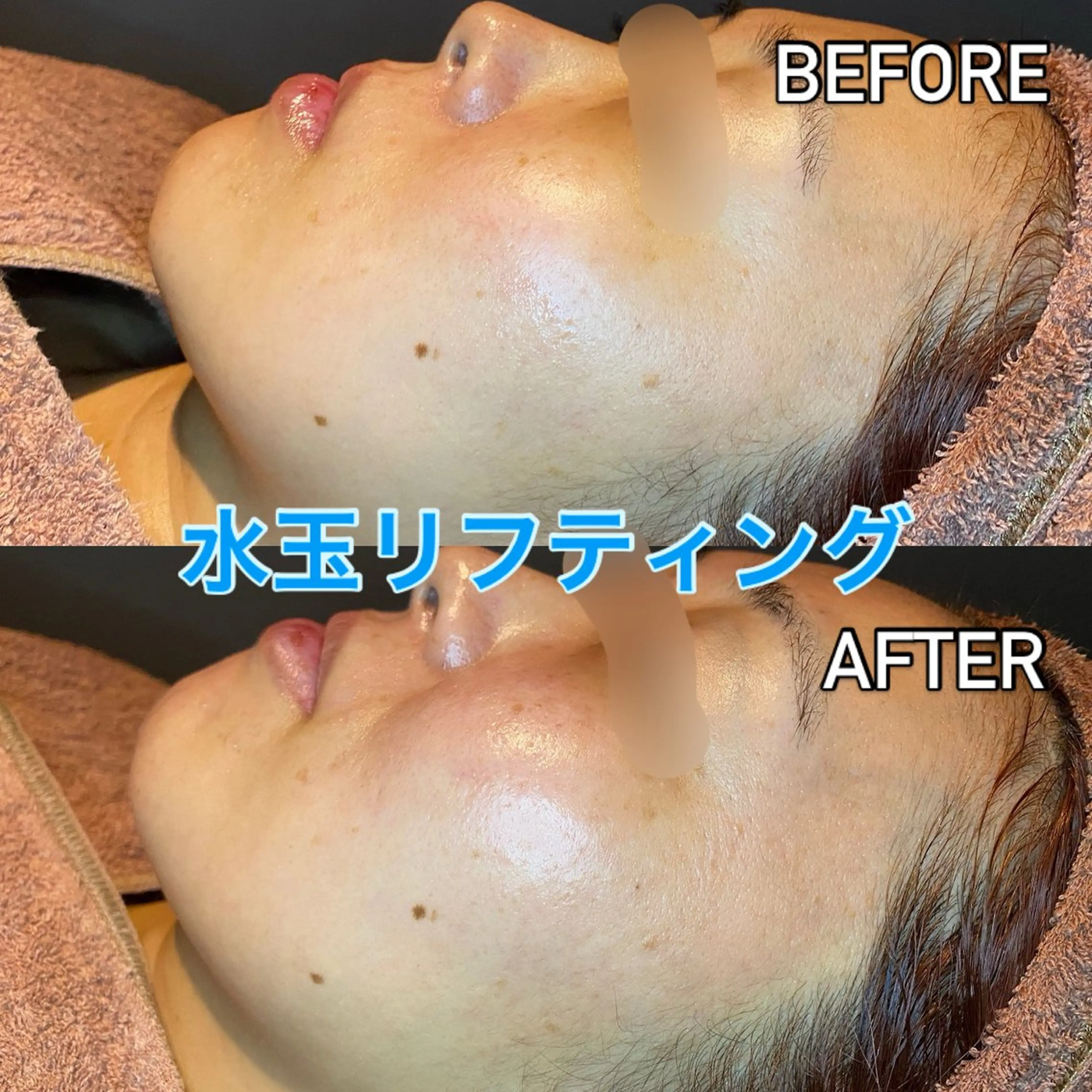 🇰🇷韓国で大人気🇰🇷水玉リフティング🫧赤ちゃんのようなふわふわお肌に👼の写真