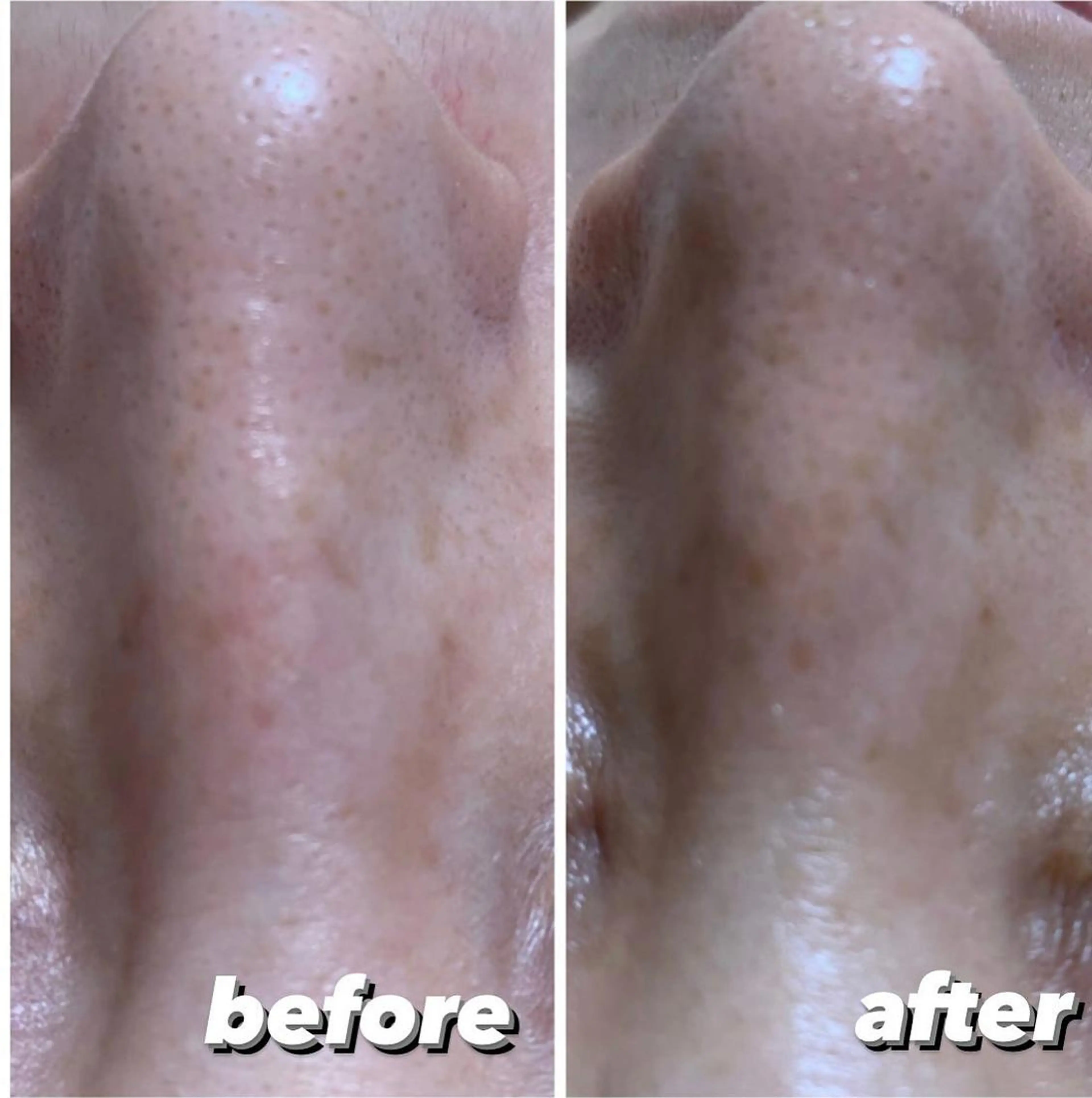 EMILU CAのエステ・リラクイメージ