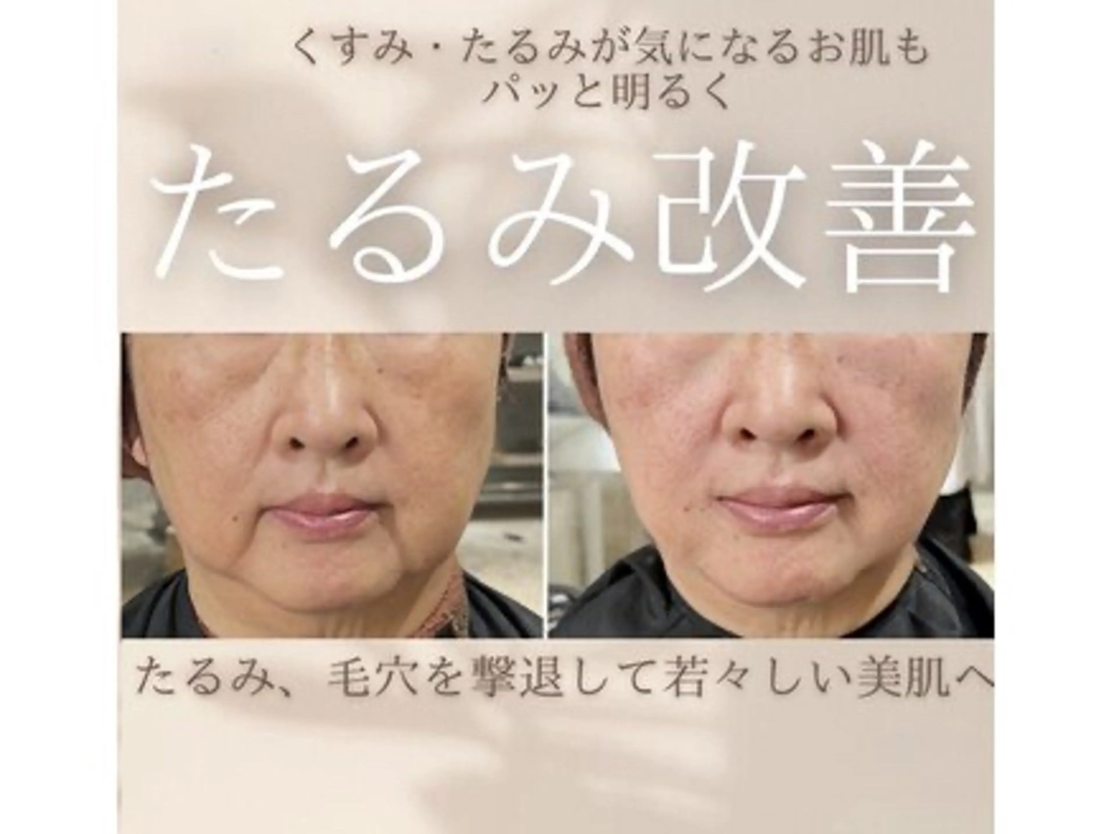 エステ 服部 先生のエステ・リラクイメージ