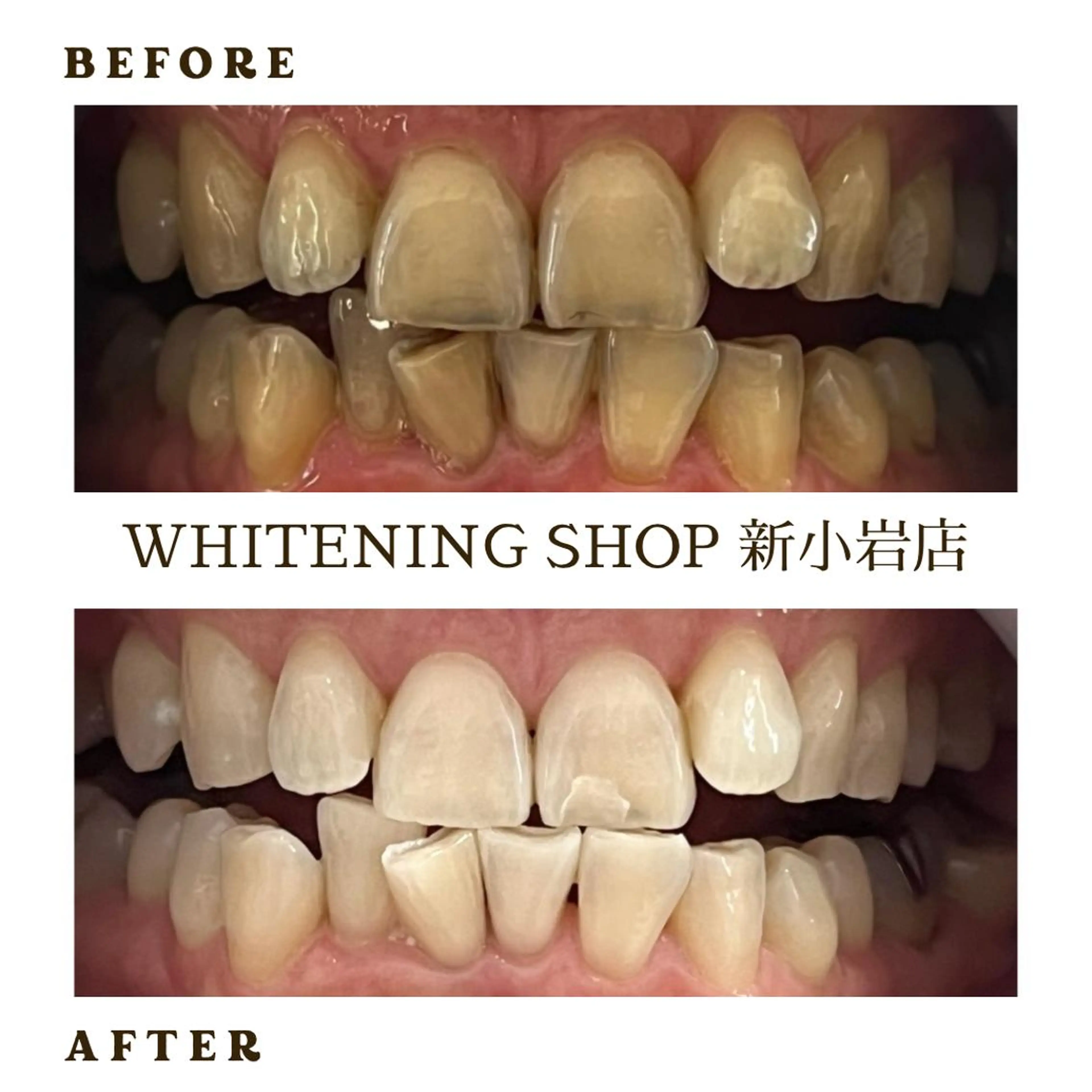 メンズ ホワイトニング ショップ新小岩店のその他イメージ