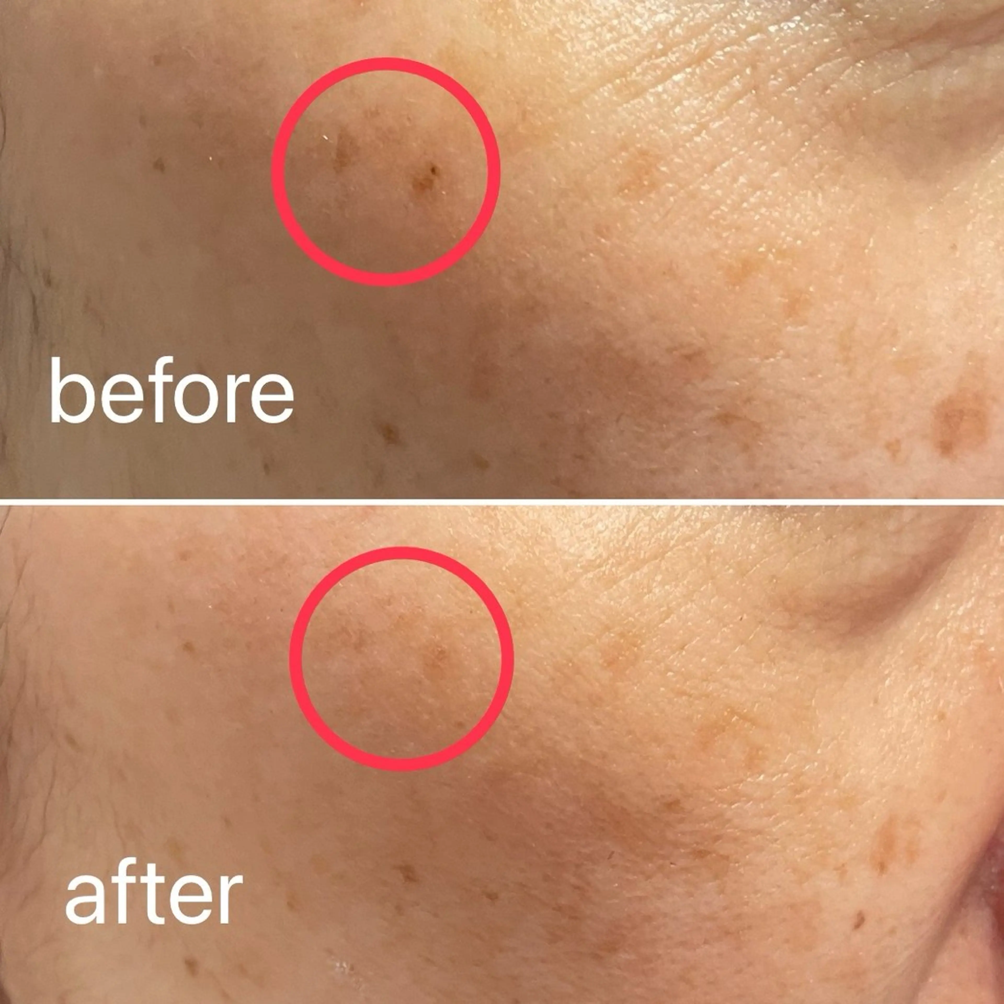 痛くないシミ取り 【荻窪】石橋のヘアスタイル