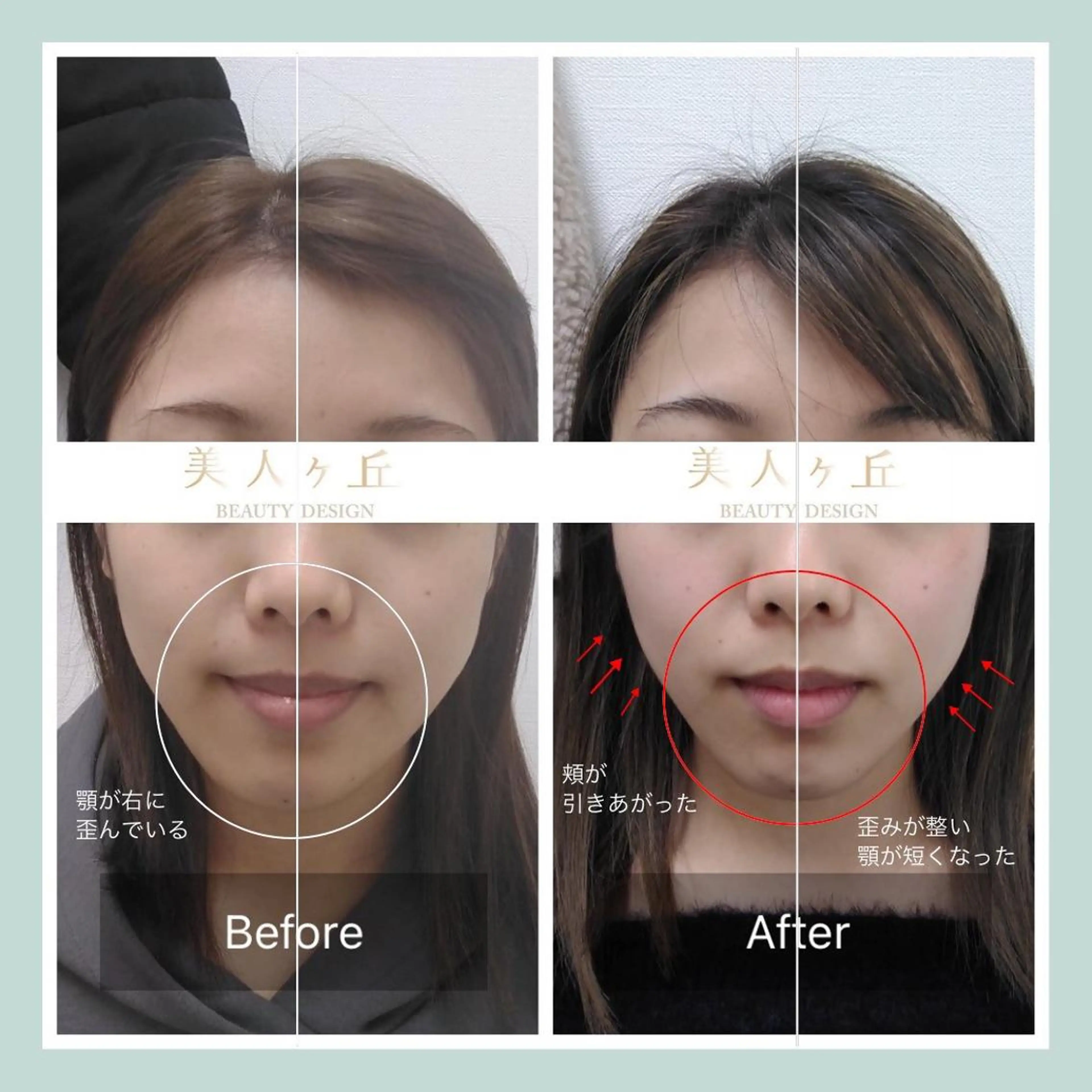 韓国/ヌーディー系 ネイル自由が丘のネイルデザイン