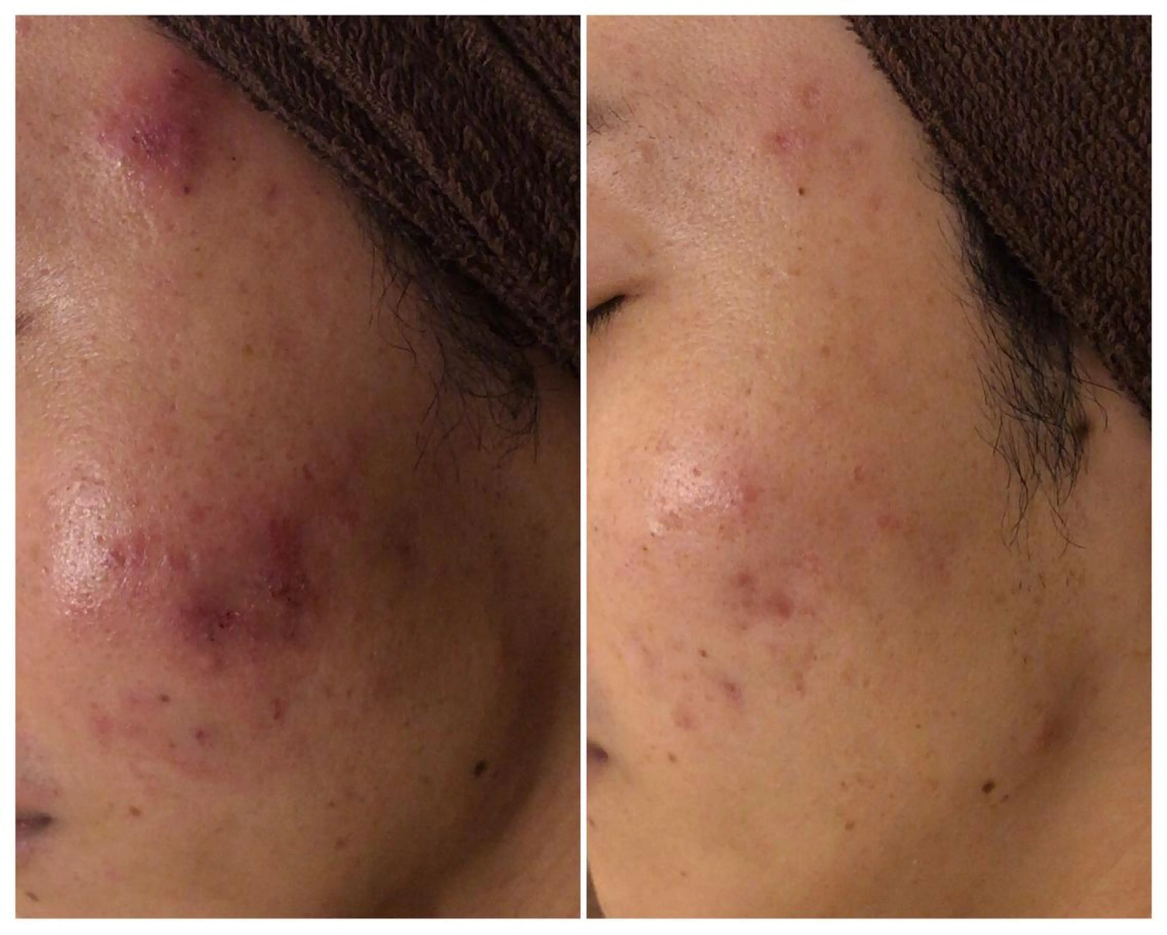 ミディアム カラー パーマ ヘアアレンジ メンズ キッズ ネイル マツエク・マツパ ニキビ・肌質改善専門 ♡人生が変わるサロンのエステ・リラクイメージ