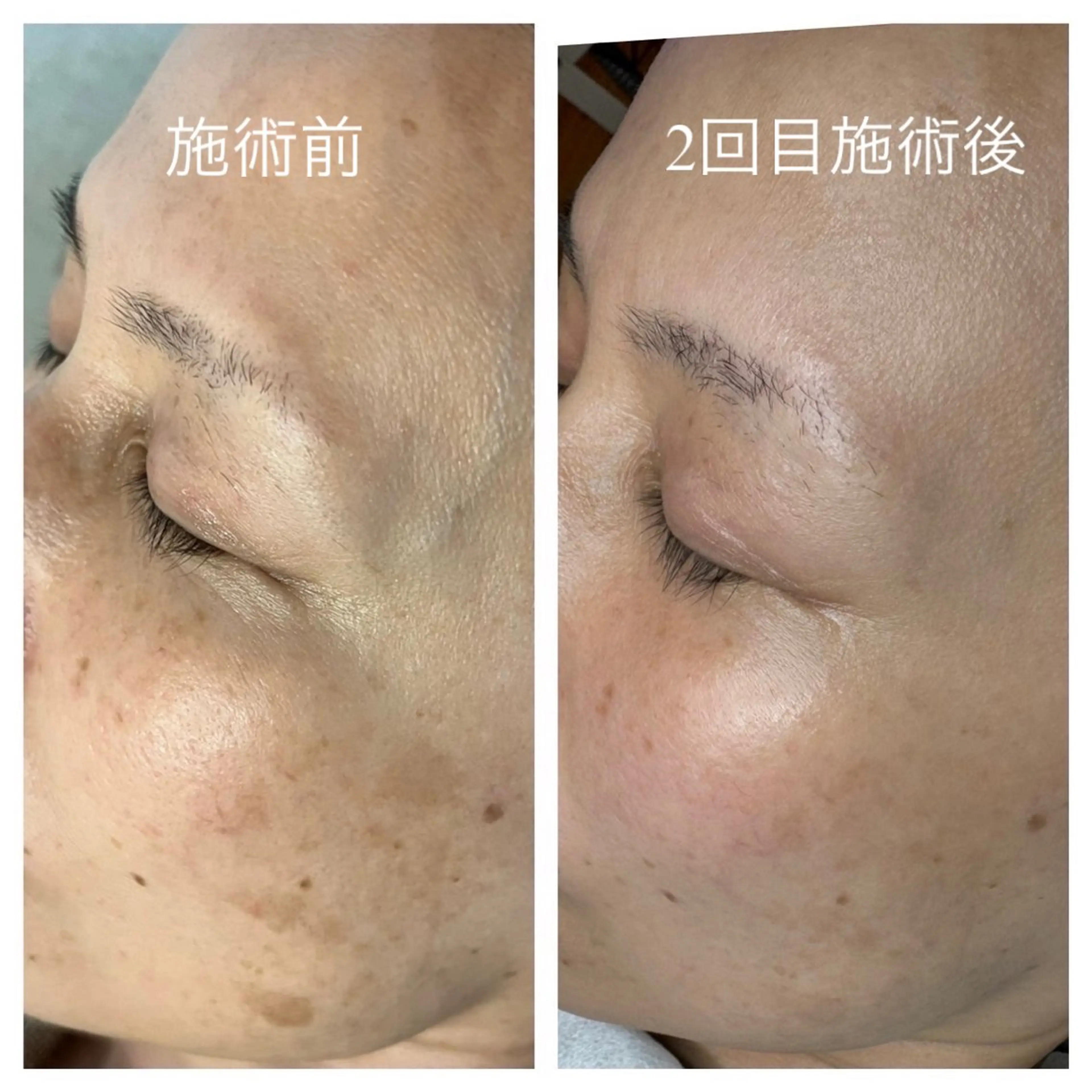 エステ スリーエスプラス内　美肌サロンEme所属・希映 -kieのエステ・リラクイメージ