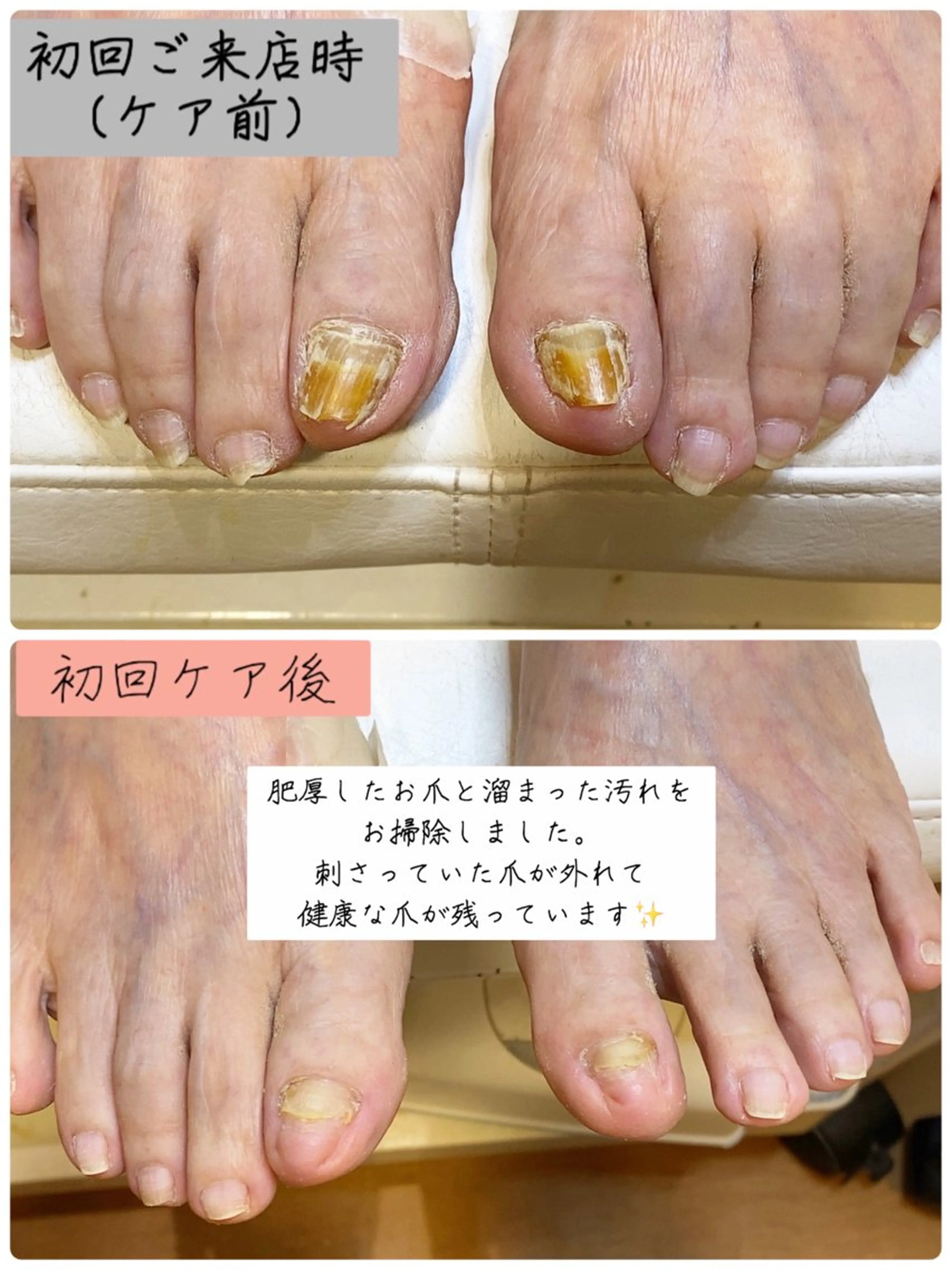 ネイル フットネイル フットネイル Studio Jivanのネイルデザイン