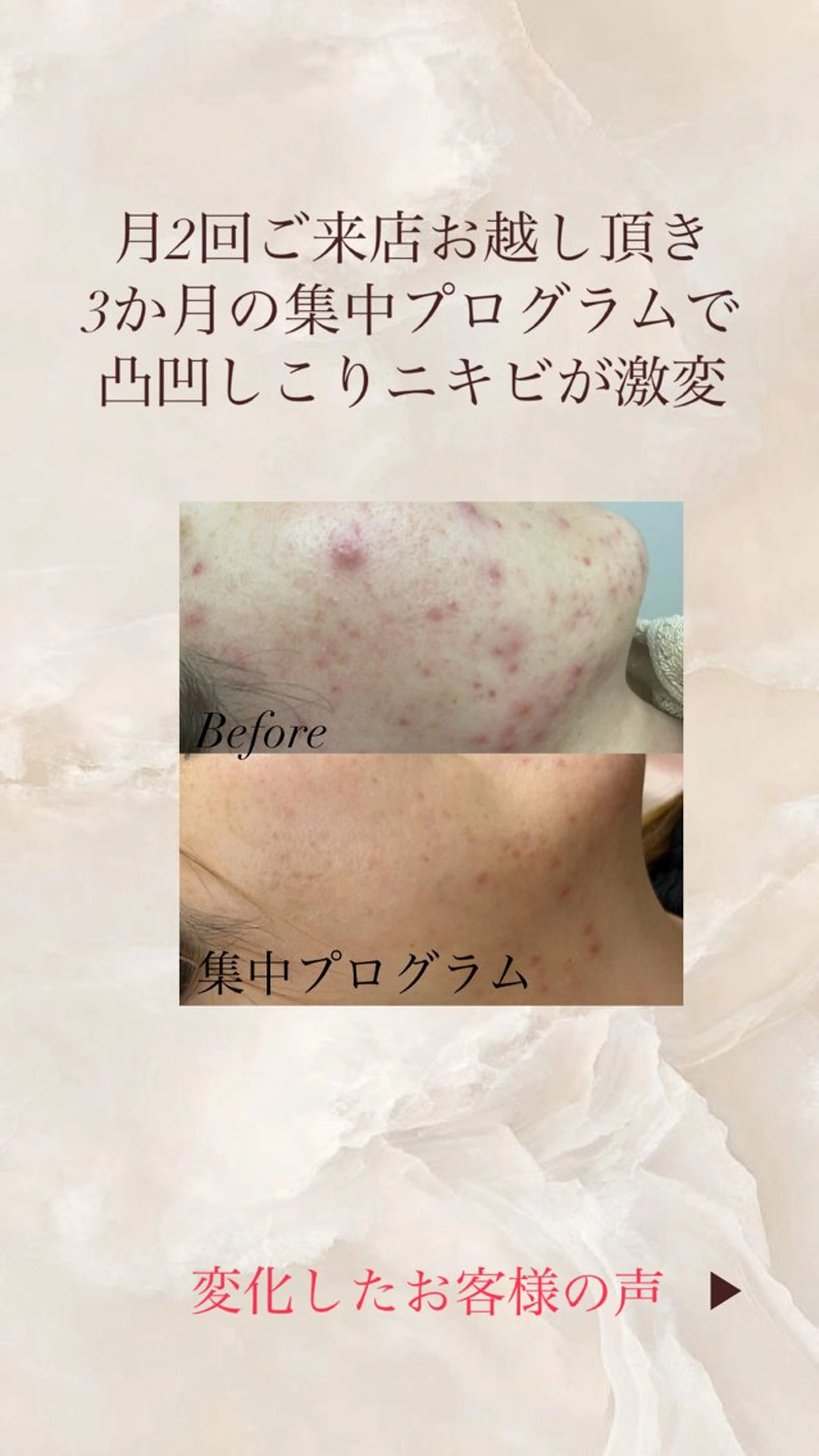 エステ 藤田 わかなのエステ・リラクイメージ