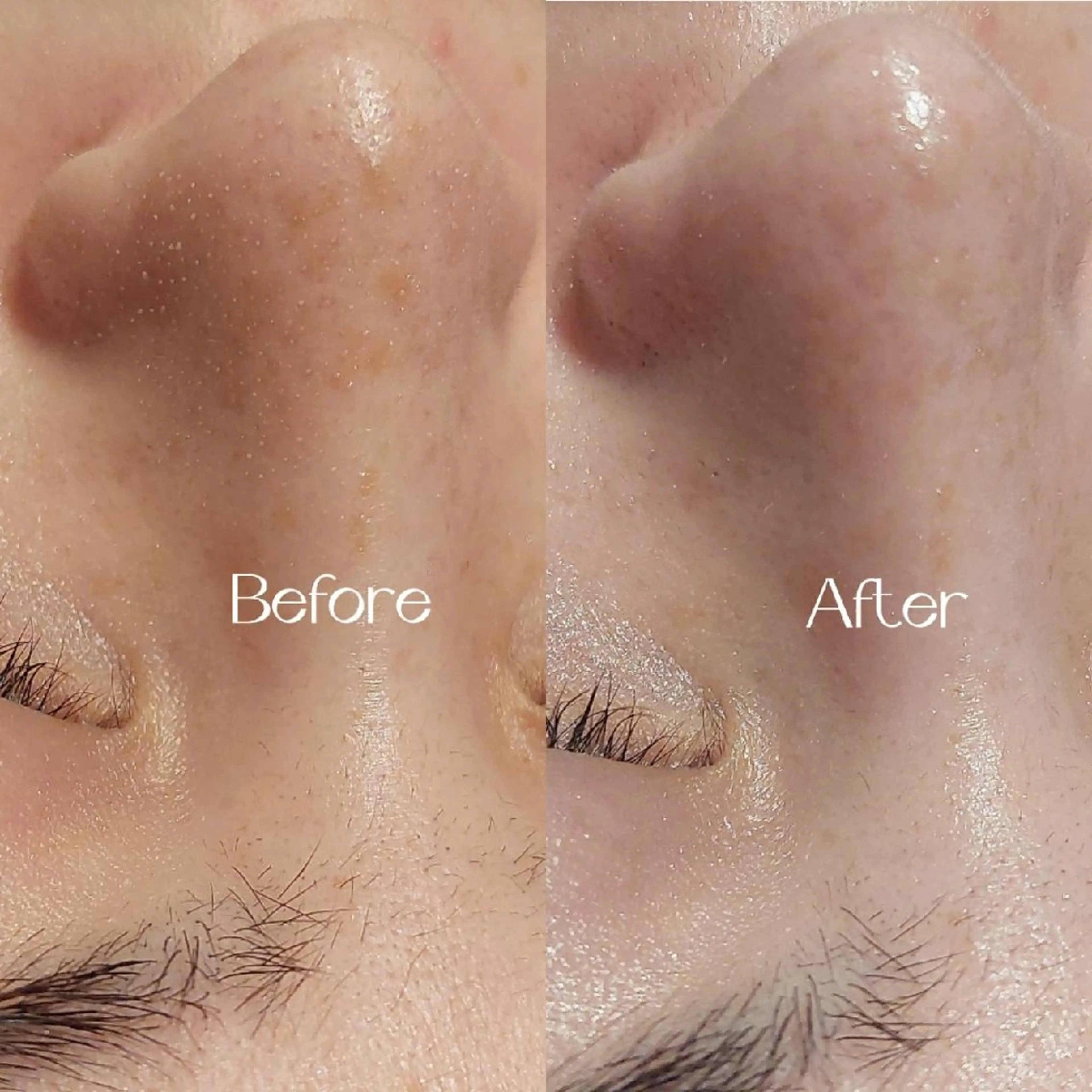 エステ MyFairLady miuのエステ・リラクイメージ