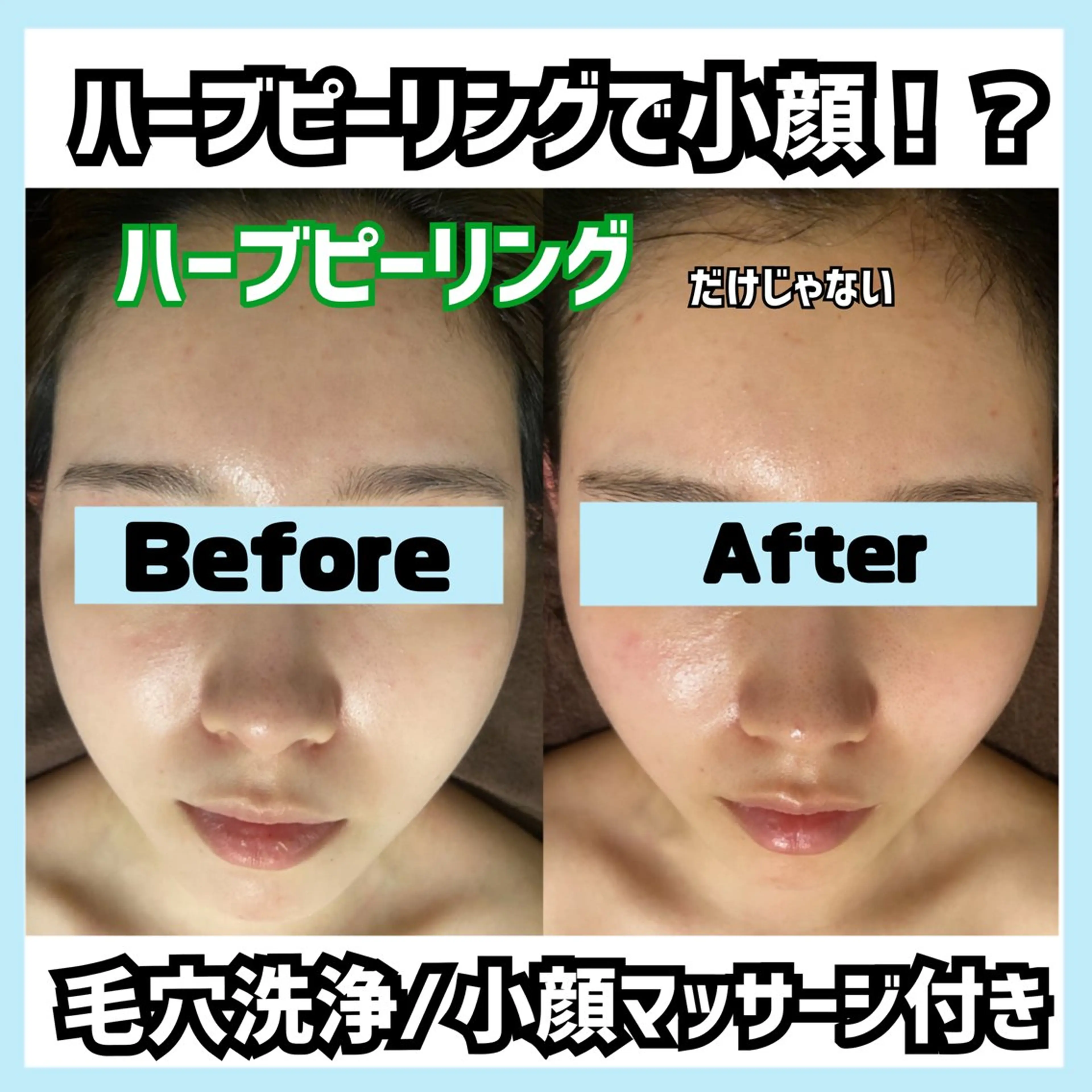 オールハンド専門🤍 痩身/小顔/ ハーブのエステ・リラクイメージ