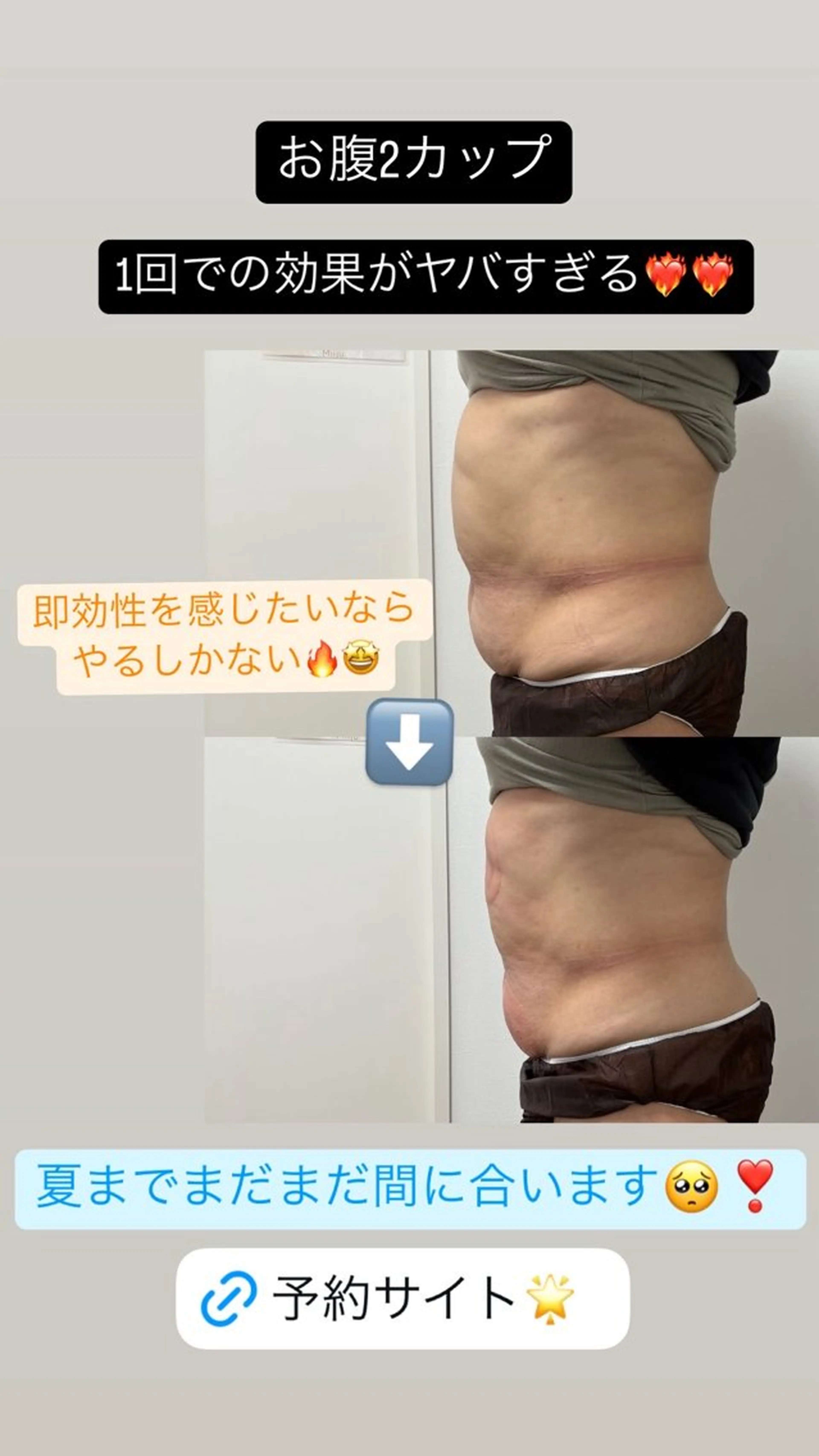 エステ Miiju.所属・石巻 冷却痩身 Miiju. 鈴木のエステ・リラクイメージ