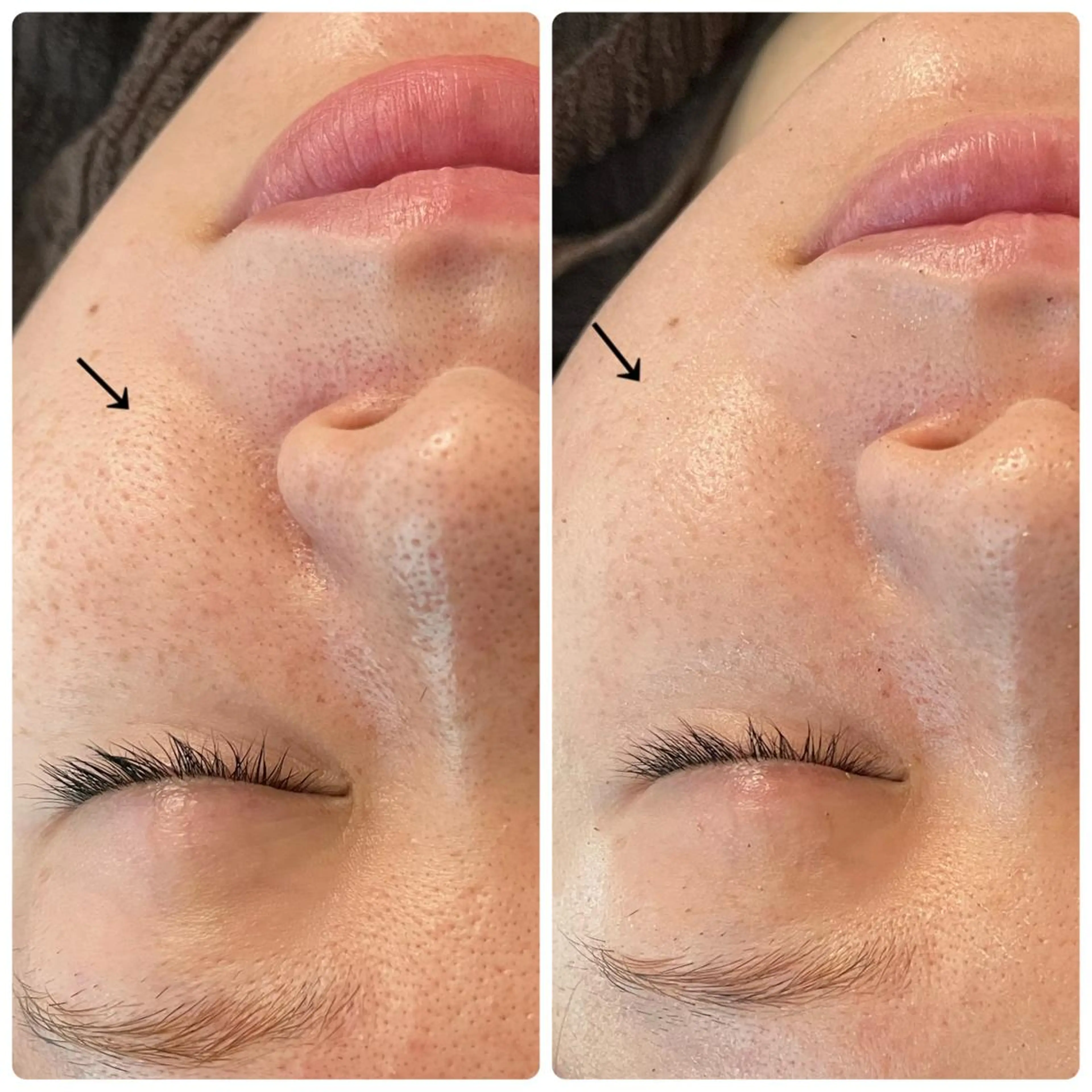 luana beauty所属・kana ハーブピーリング🌿のエステ・リラクイメージ