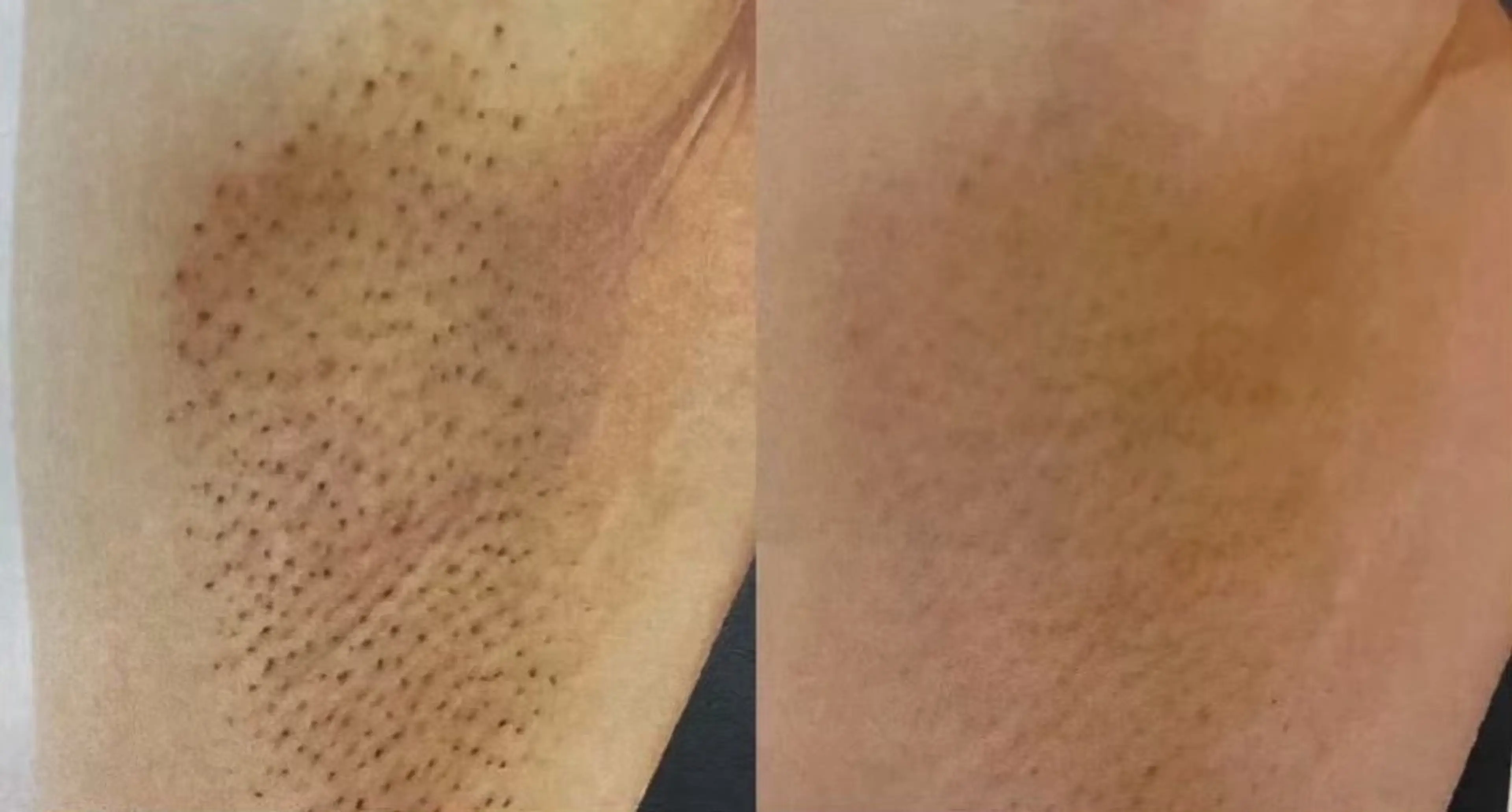 エルモサ痩身脱毛 西八王子店のエステ・リラクイメージ