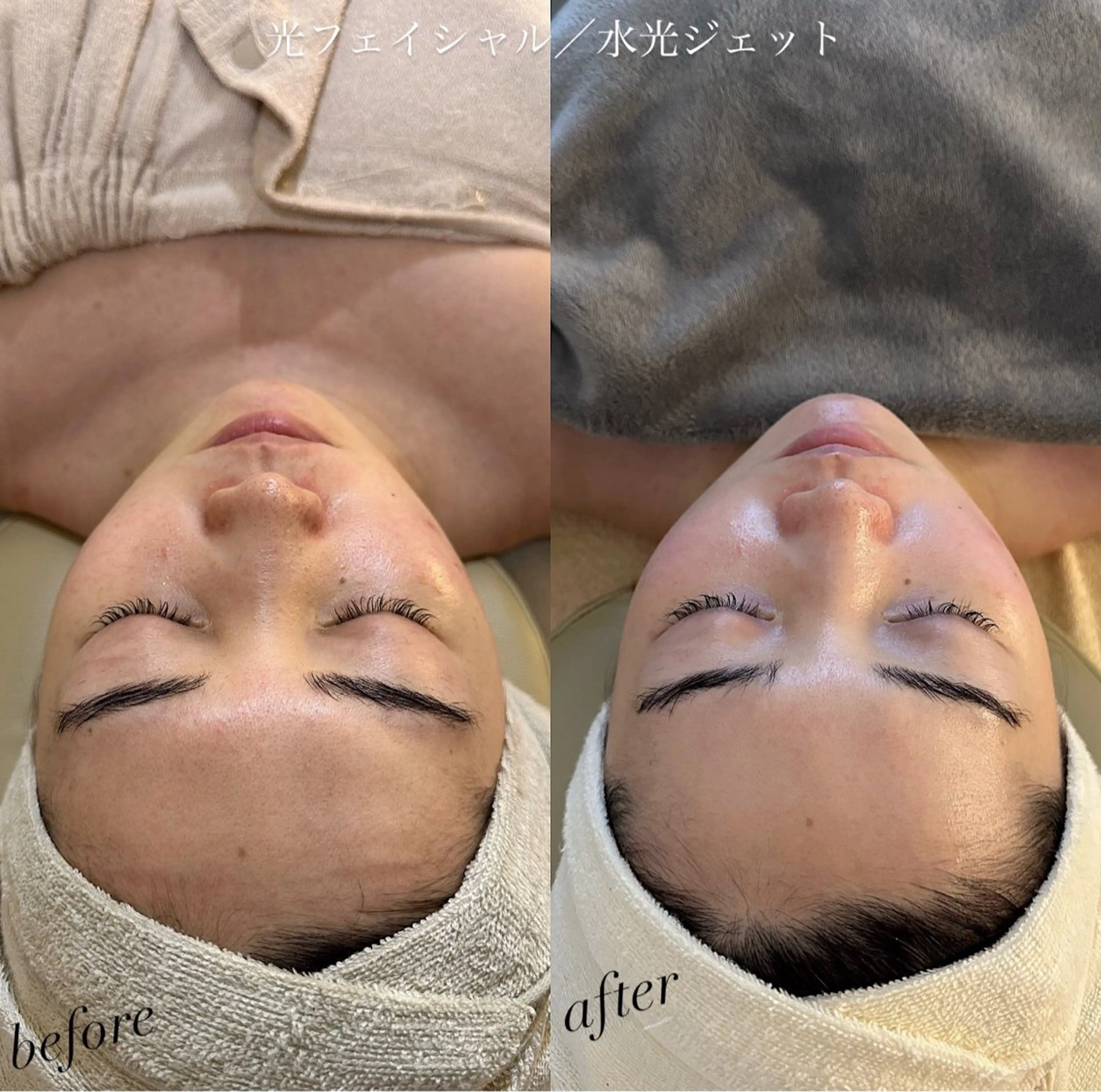 うなじ脱毛/美肌脱毛 LABELのエステ・リラクイメージ