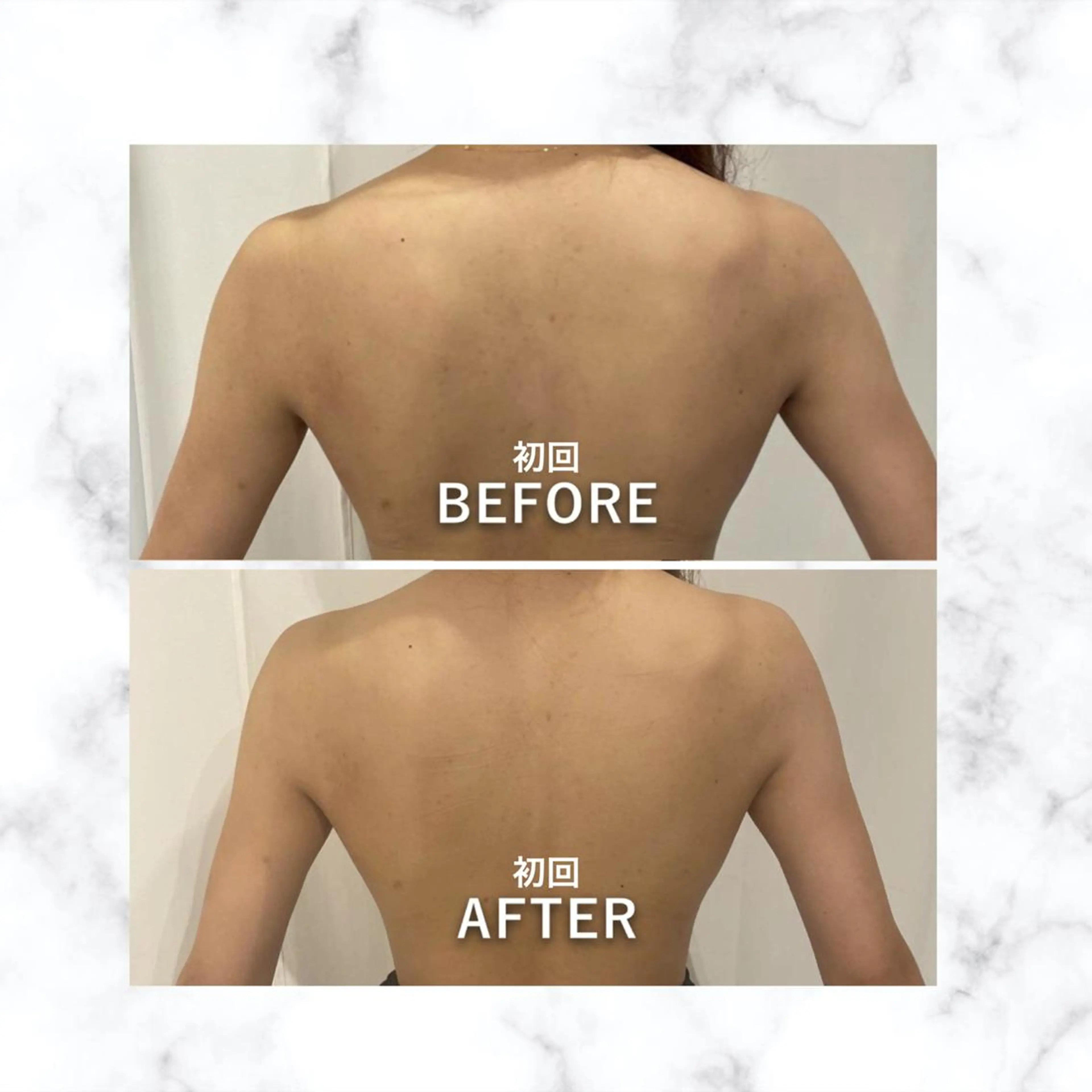 エステ リラク 12Dハイフ💗 最強小顔のエステ・リラクイメージ