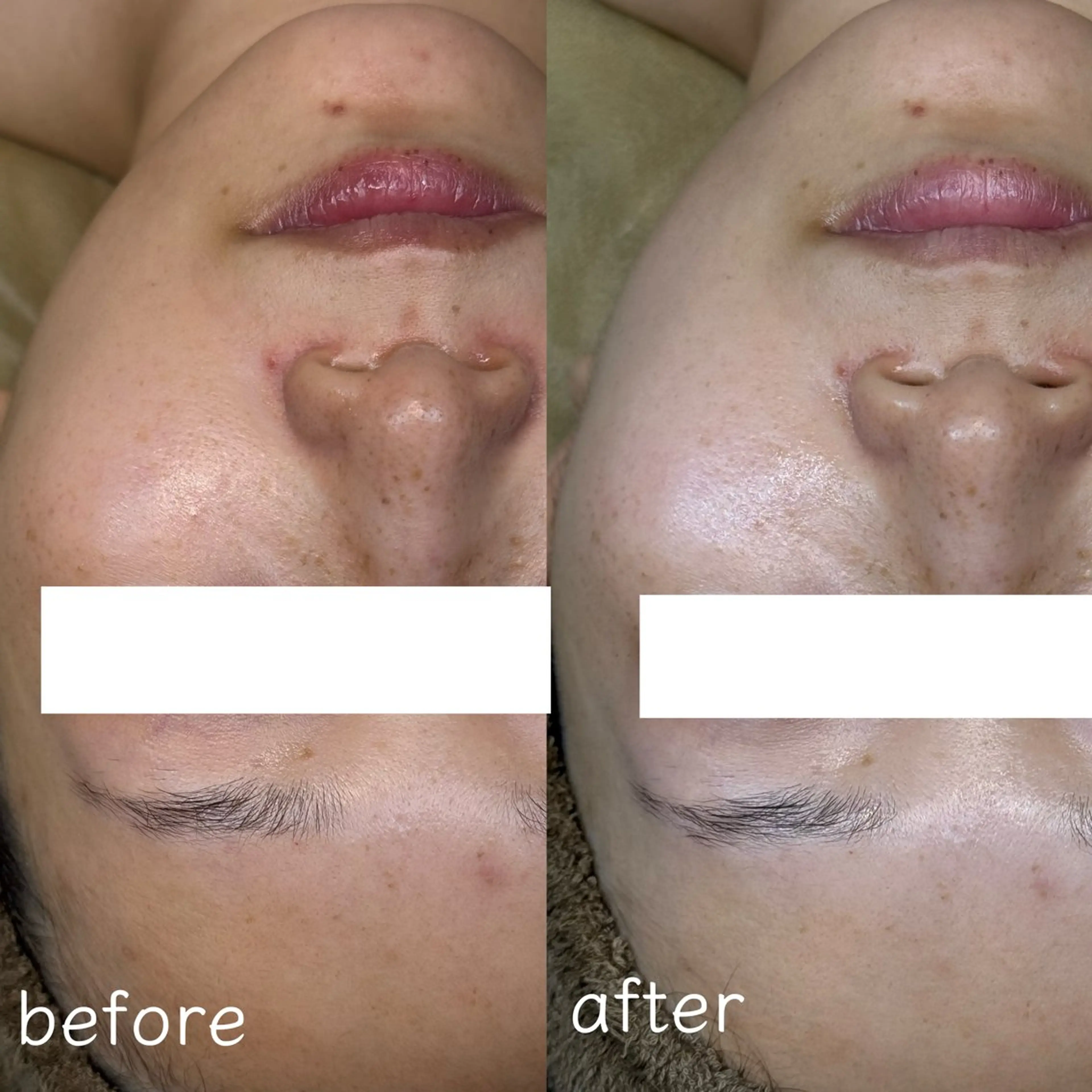 エステ 長野 美里のエステ・リラクイメージ