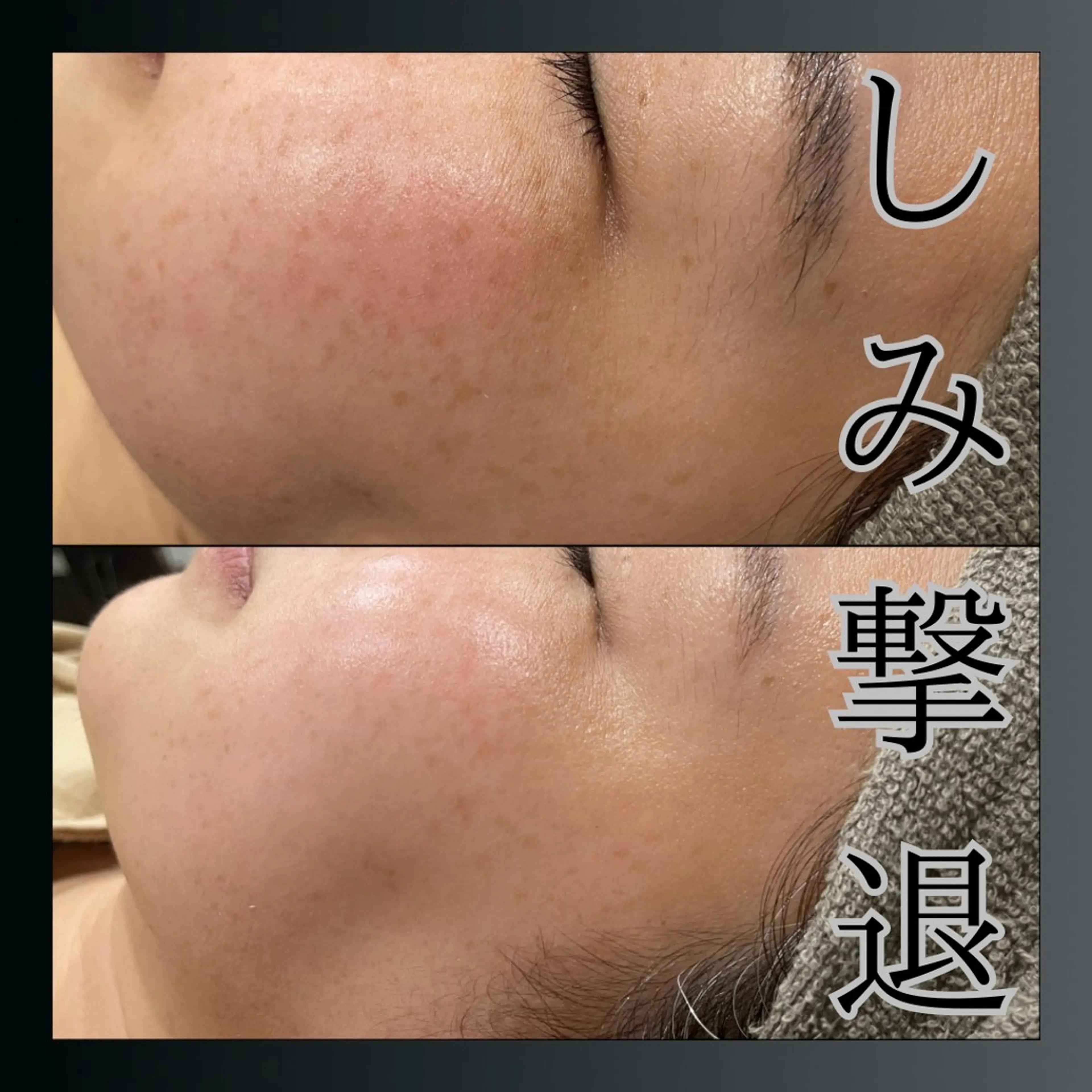 LiZA エステティックサロンのエステ・リラクイメージ