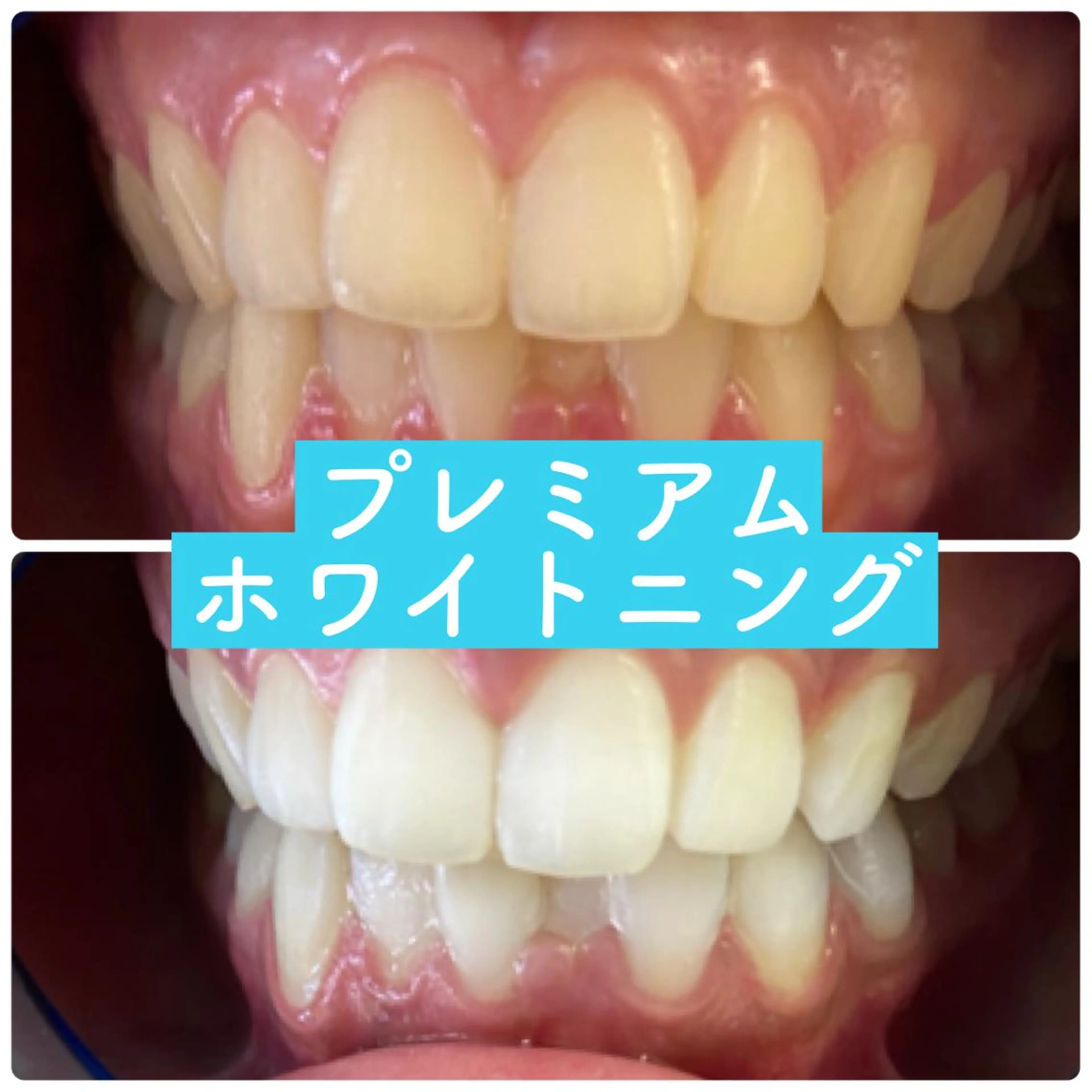 ホワイトニングルーム 横浜店のその他イメージ