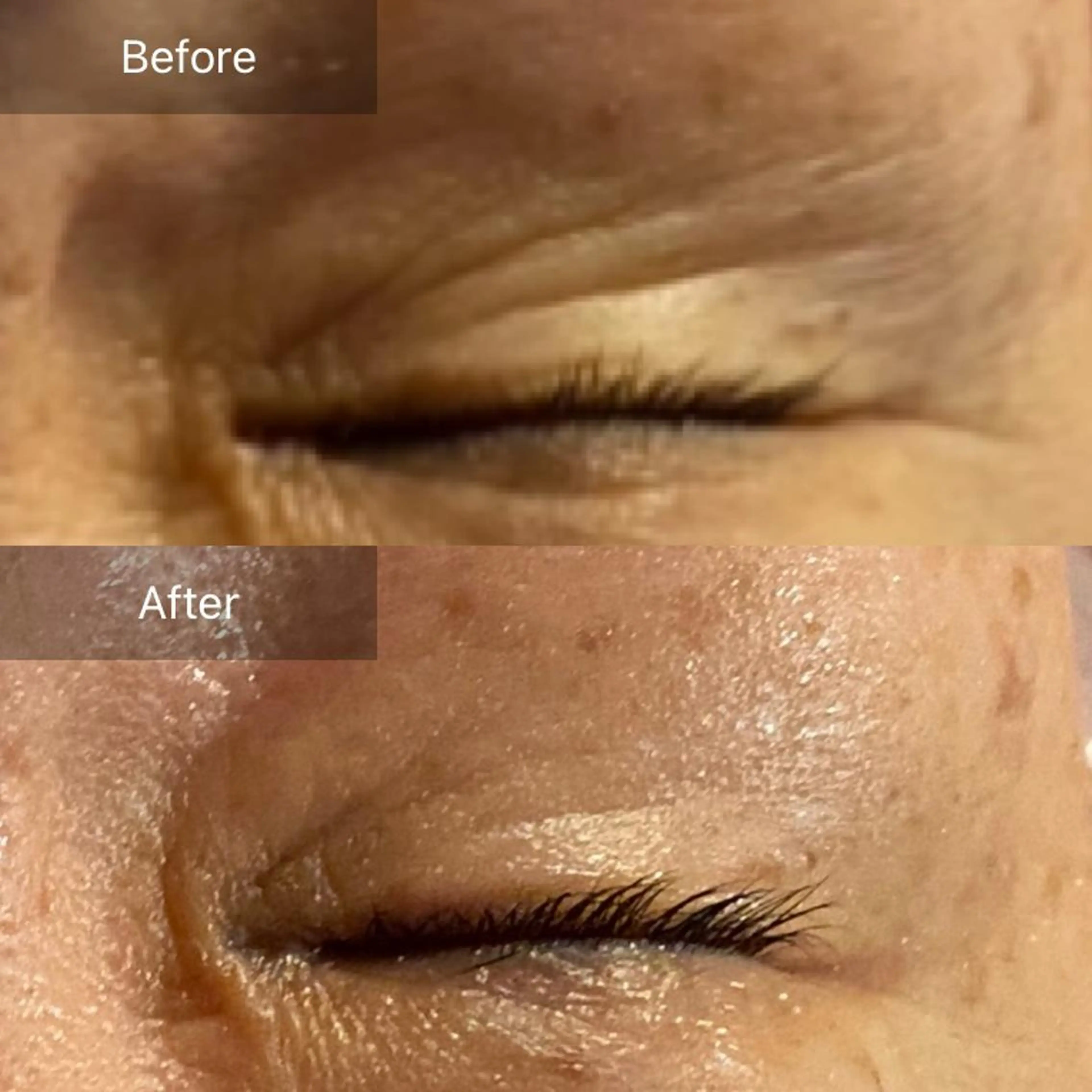 毛穴から始める肌メン テマンダリンオレンジのエステ・リラクイメージ