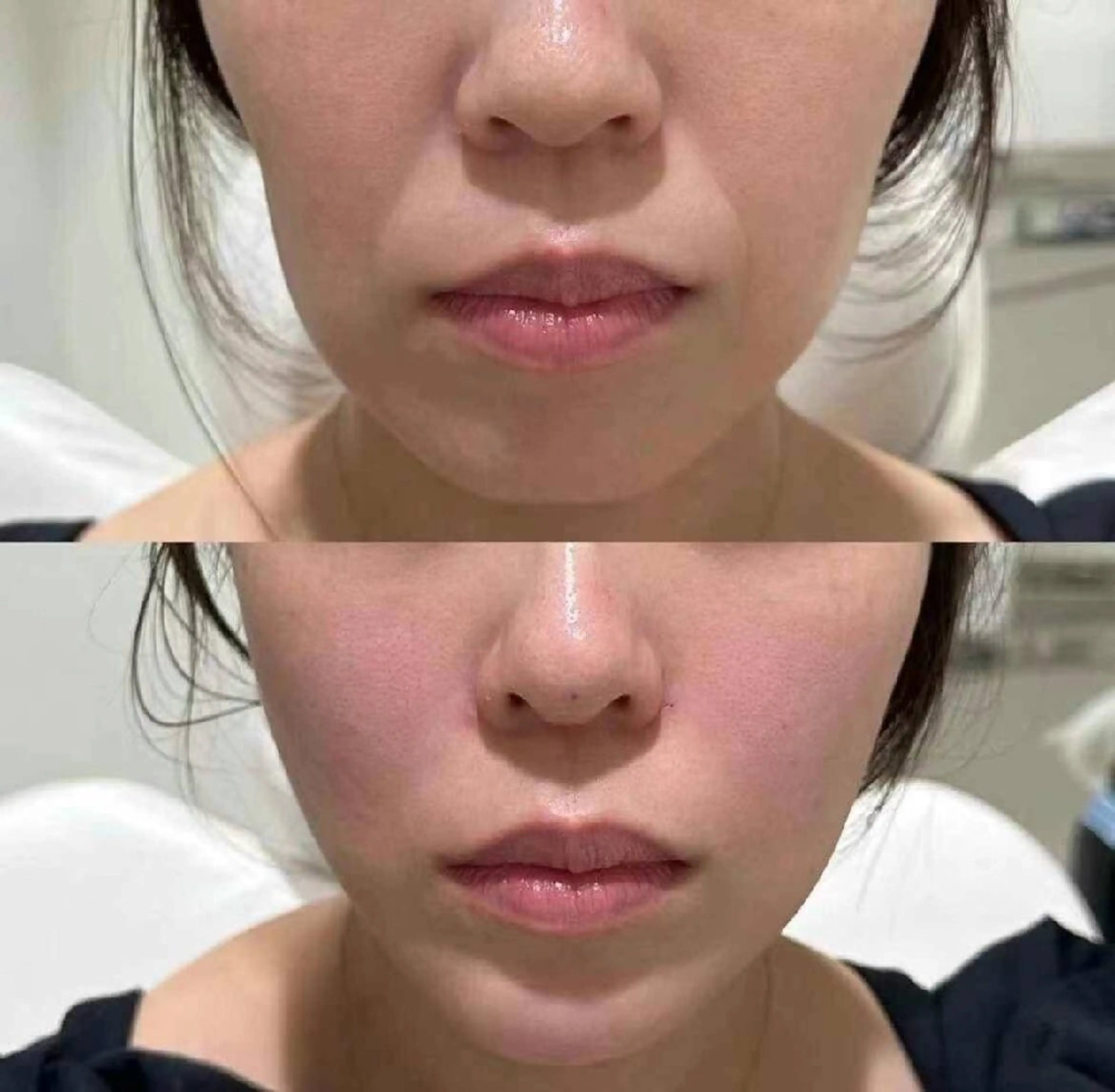 ネイル ブライダルネイル aliaハイフ&水光ジェットサロン所属・aliaハーブ水光店 エステティシャン募集のエステ・リラクイメージ