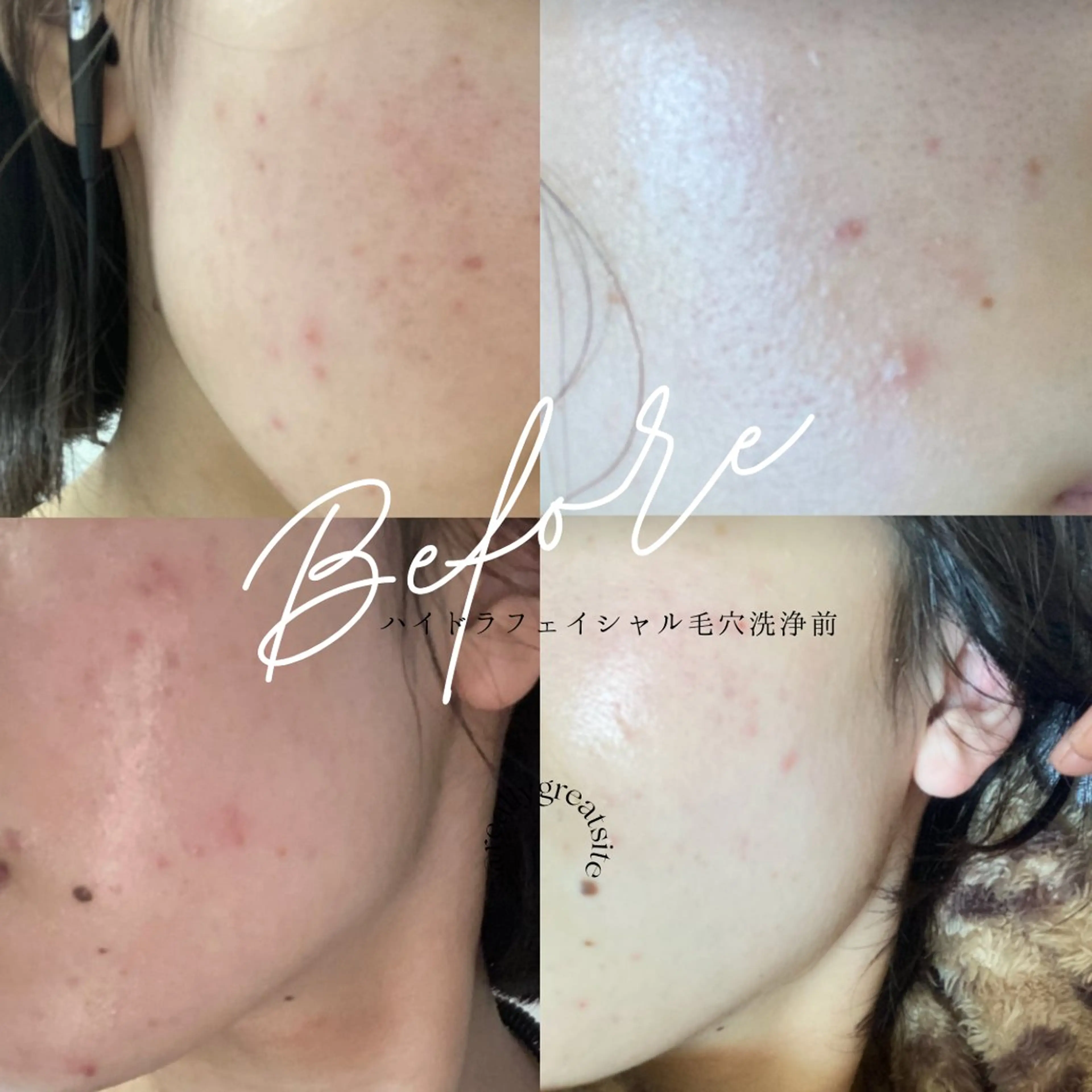 【肌質改善・腸揉み】 Nico laughのエステ・リラクイメージ