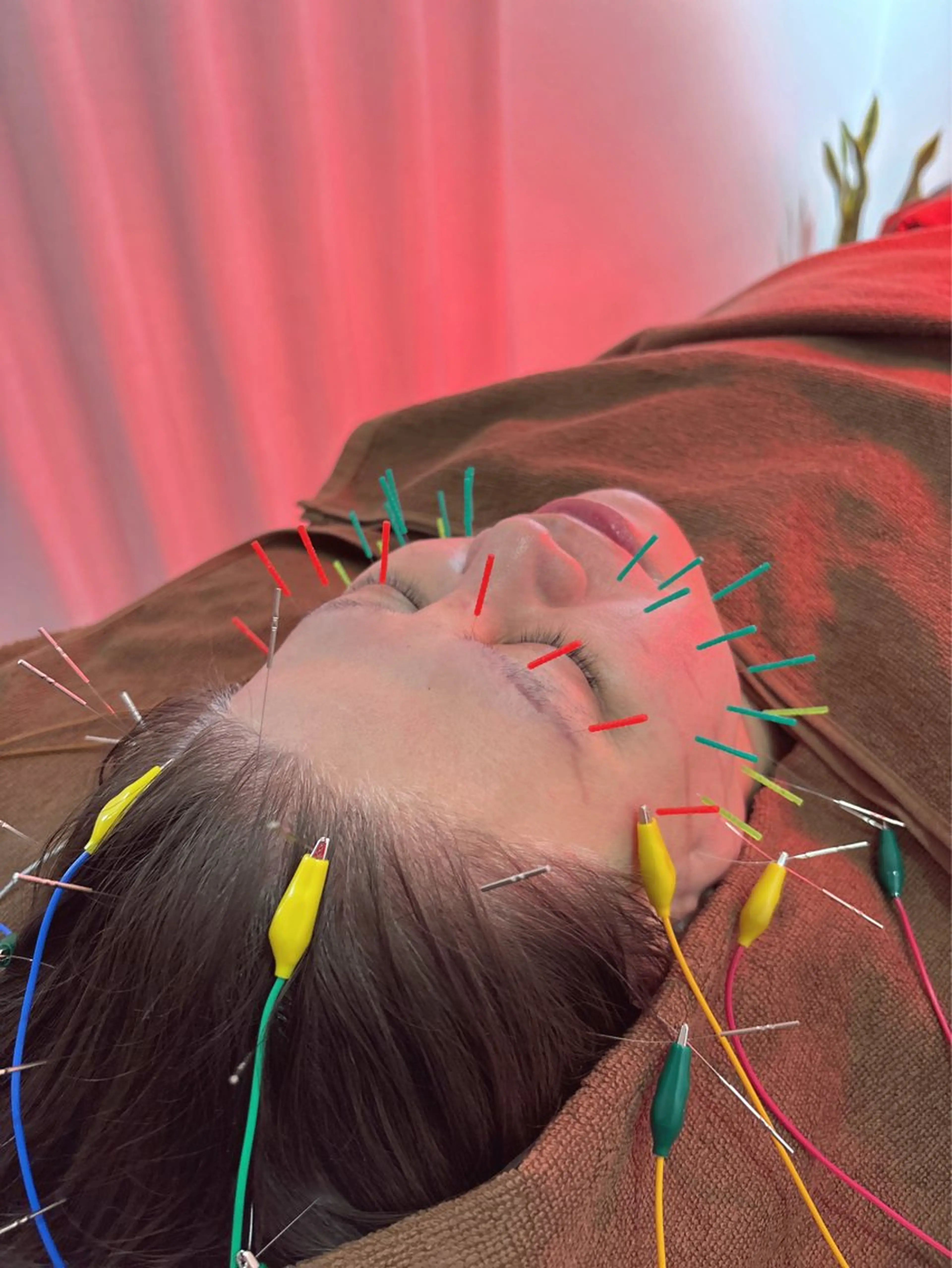 エステ リラク Spring鍼灸院 ✨首肩こり、腰痛に！のその他イメージ