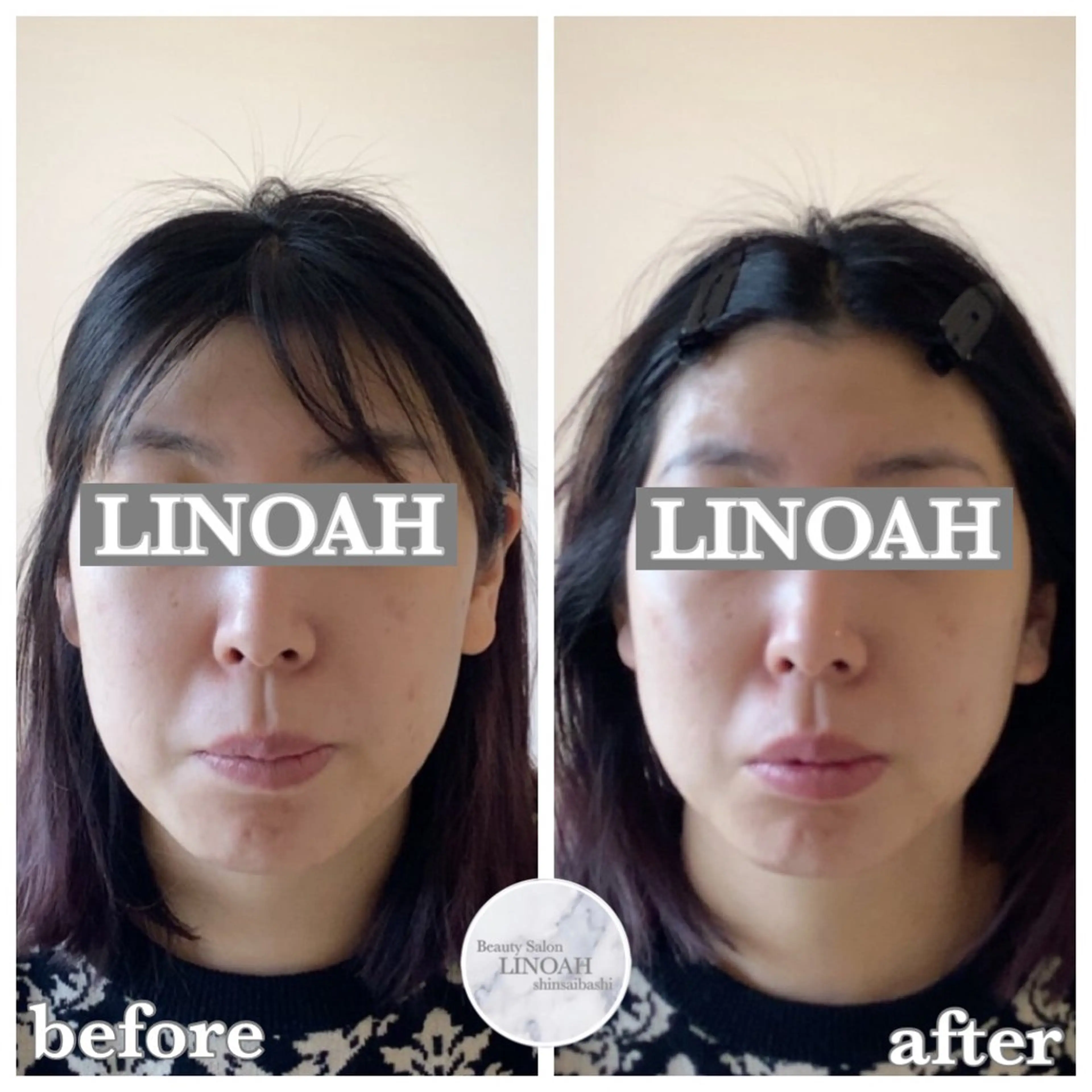 メンズ ビューティーサロン リノア心斎橋店のエステ・リラクイメージ