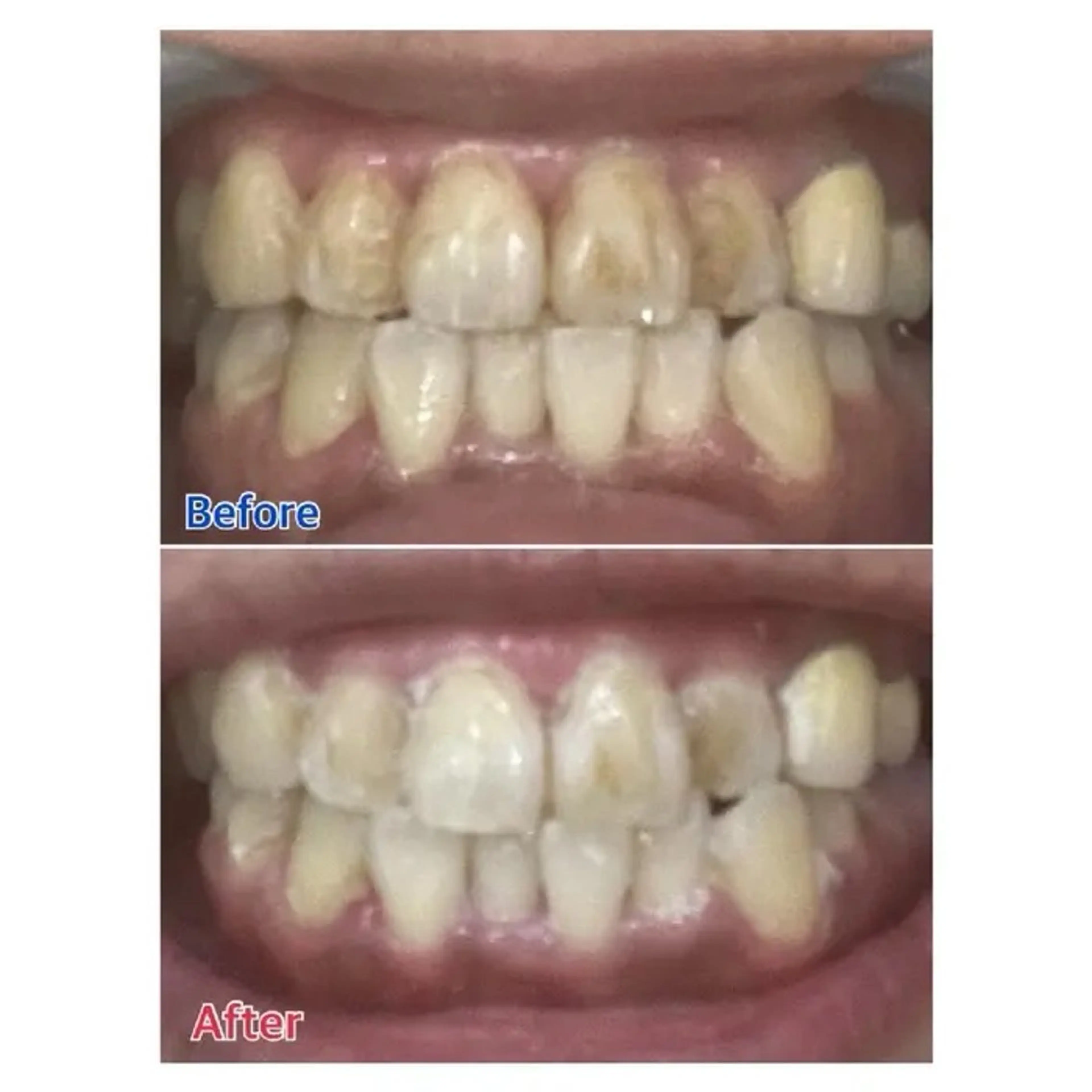 M渋谷 ホワイトニングのエステ・リラクイメージ