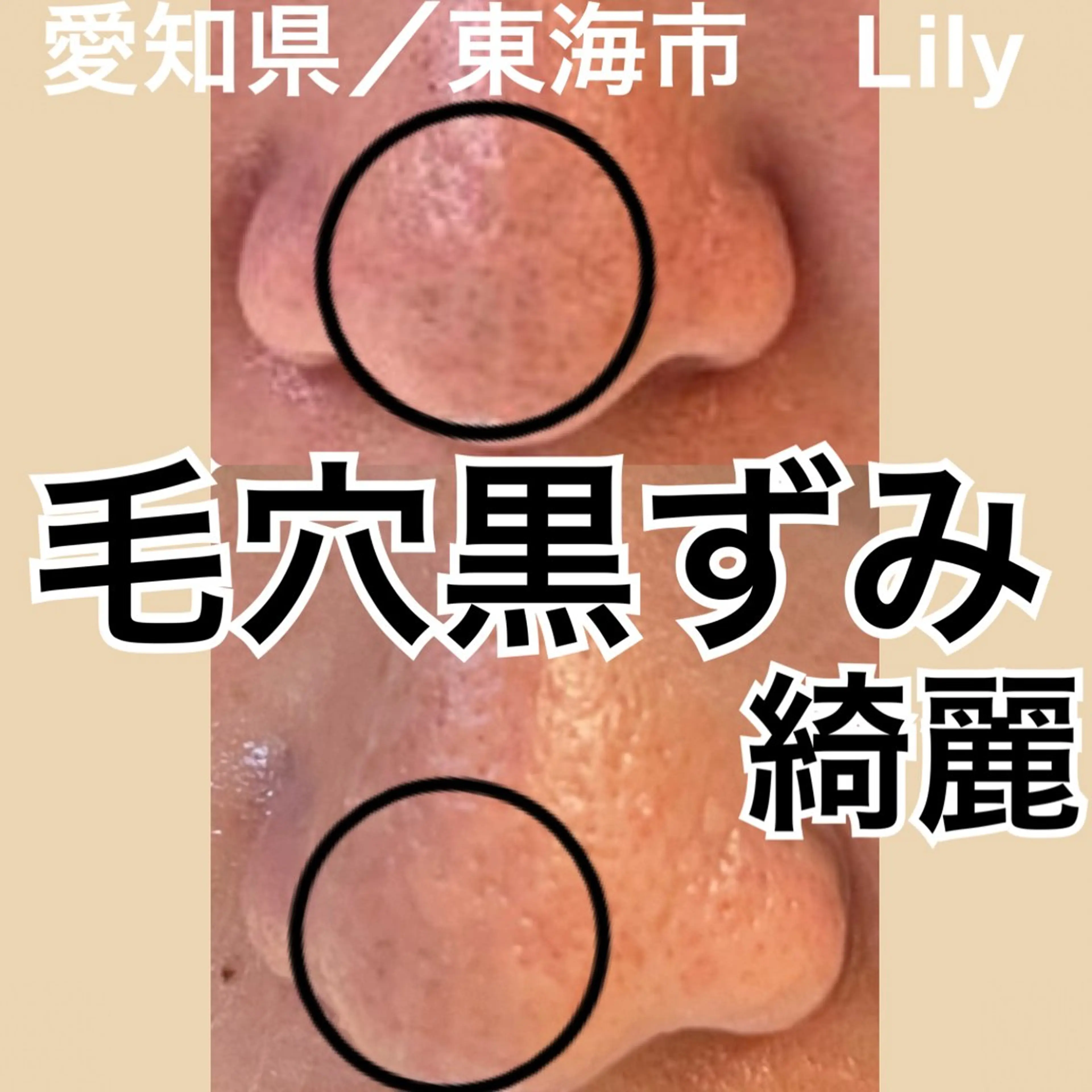 トータルビューティー サロンLilyのエステ・リラクイメージ