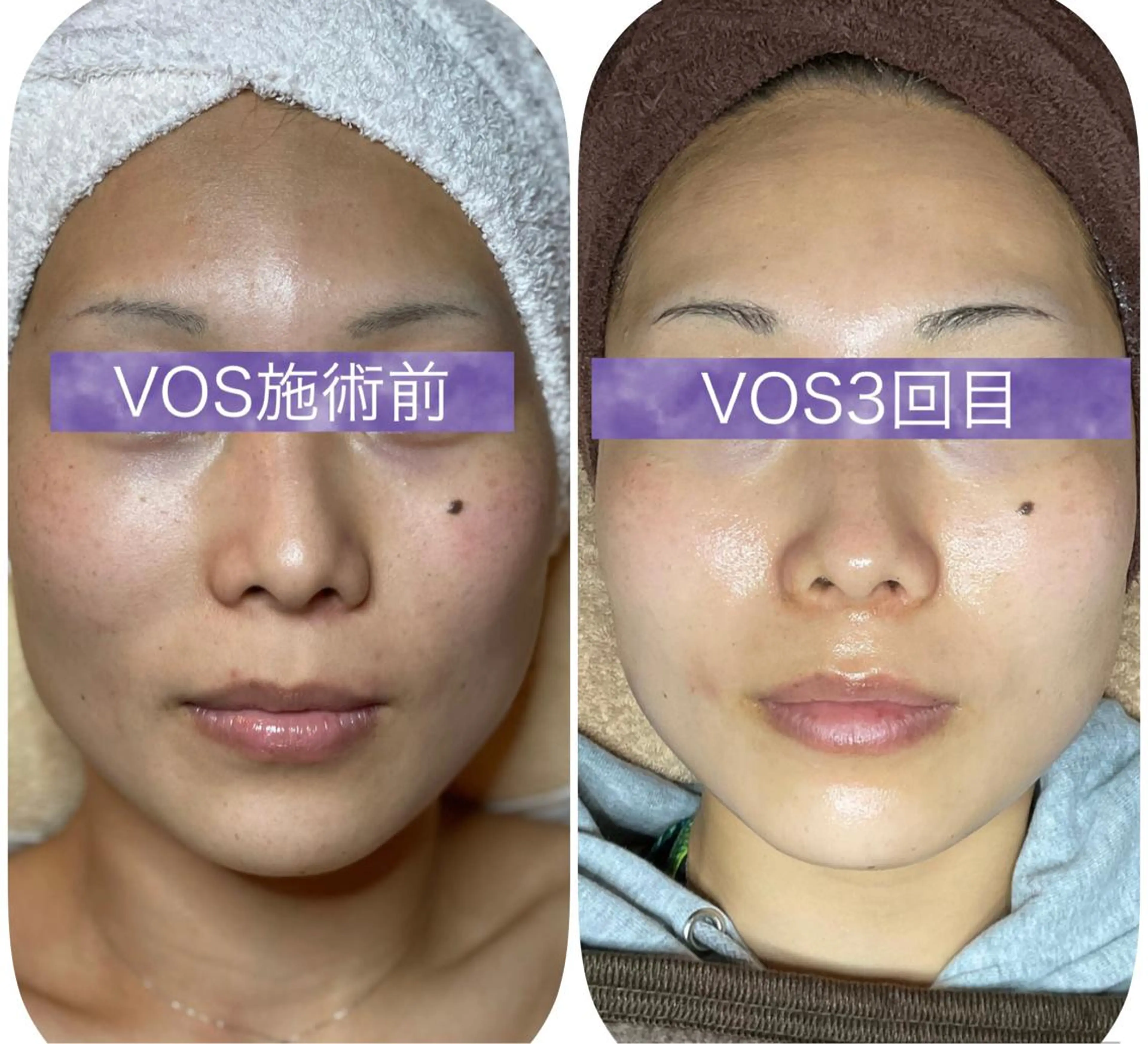 代表 MOMOのエステ・リラクイメージ