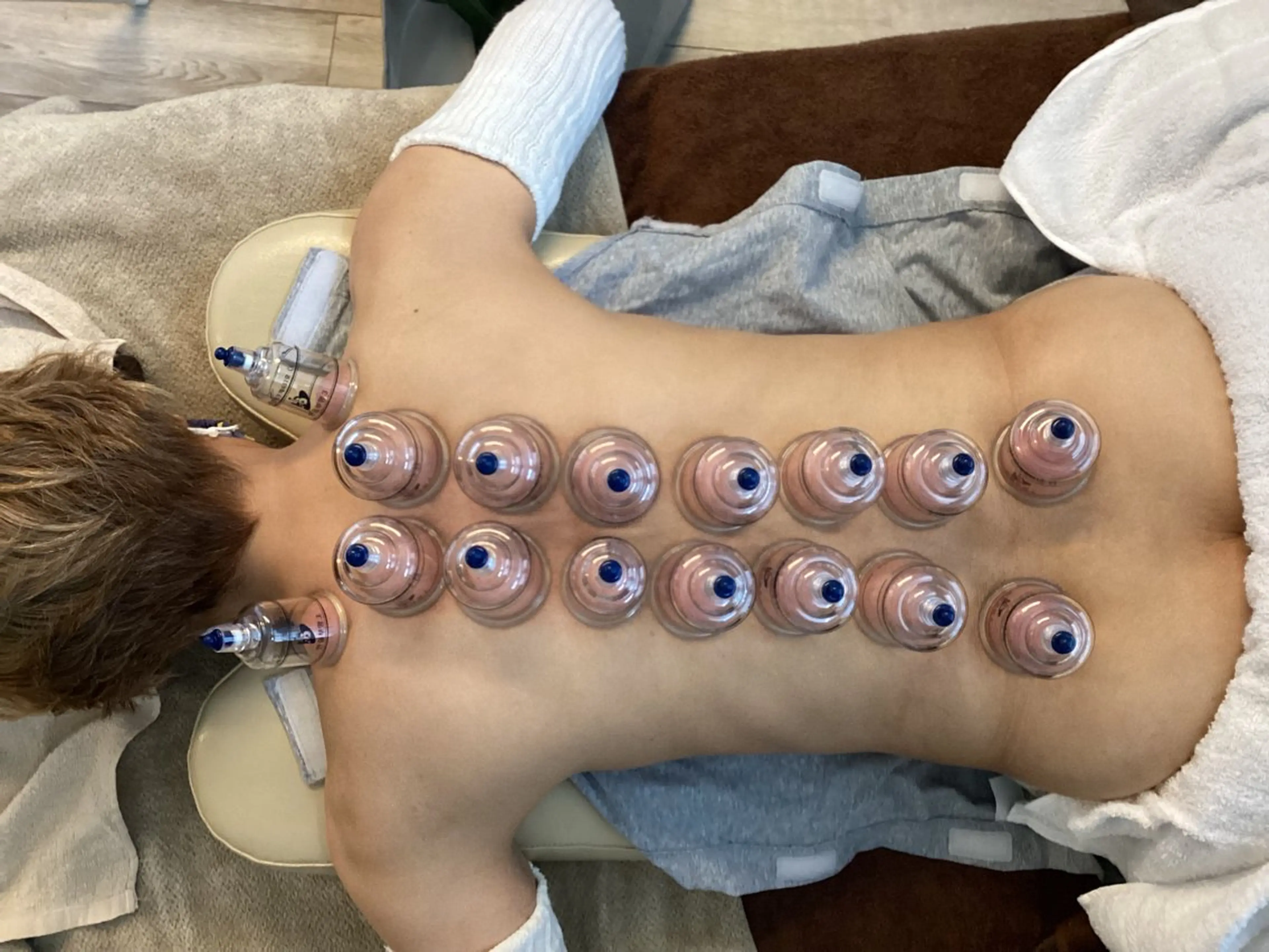 さくらんぼ鍼灸院所属・美容鍼&温活・免活 さくらんぼ鍼灸院のエステ・リラクイメージ